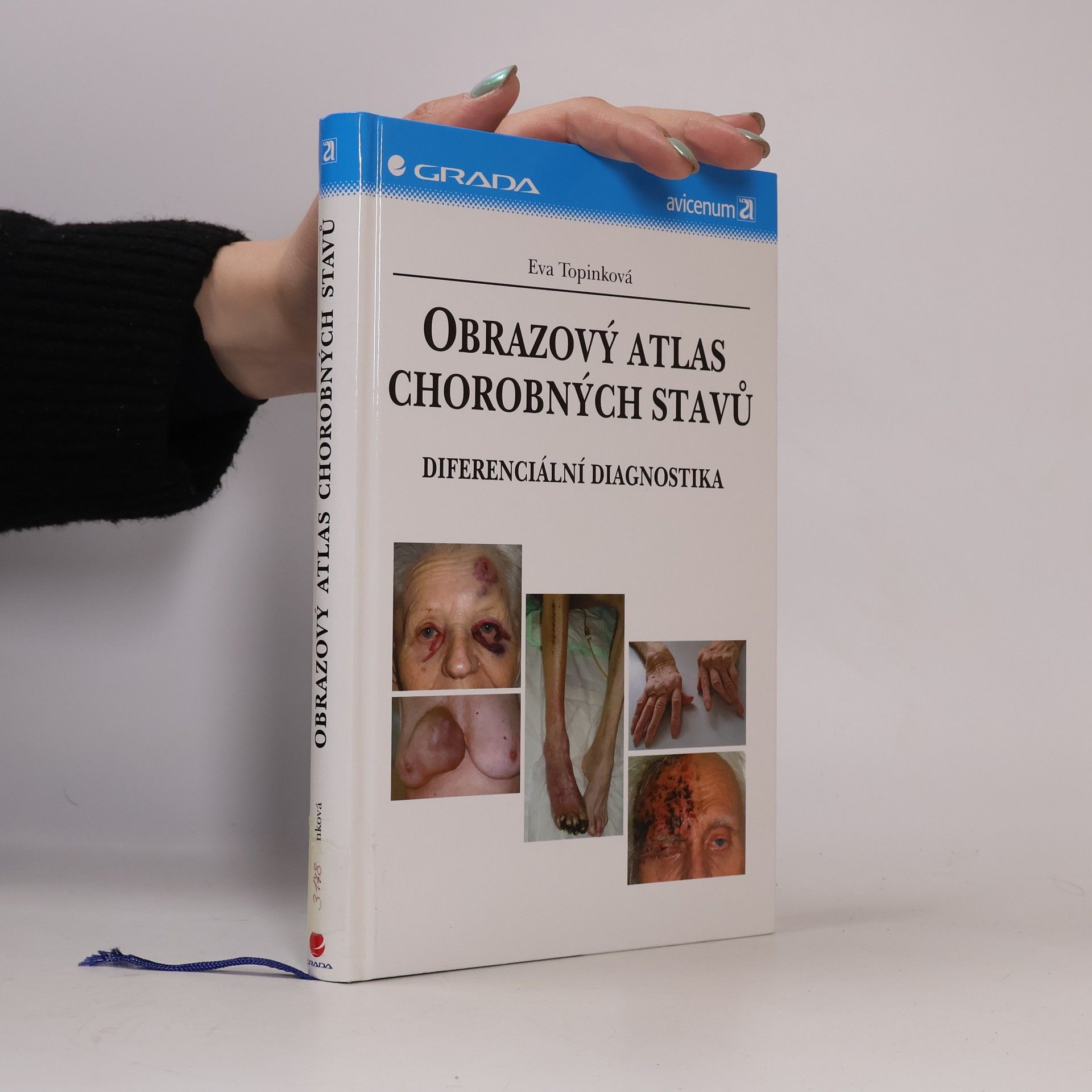 Eva Topinková Obrazový atlas chorobných stavů : diferenciální diagnostika