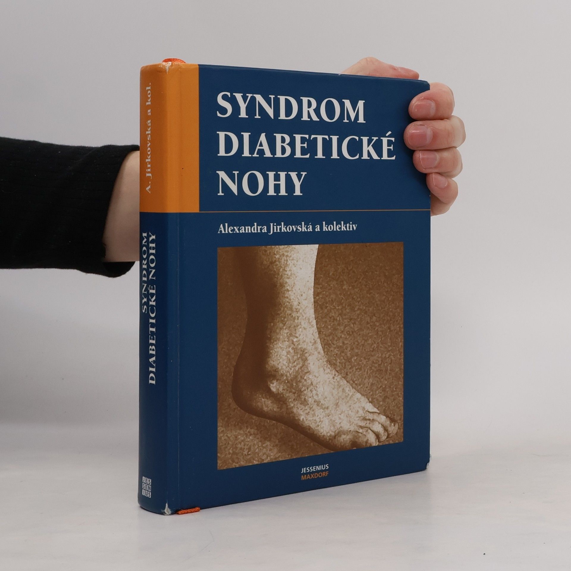 Alexandra Jirkovská Syndrom diabetické nohy