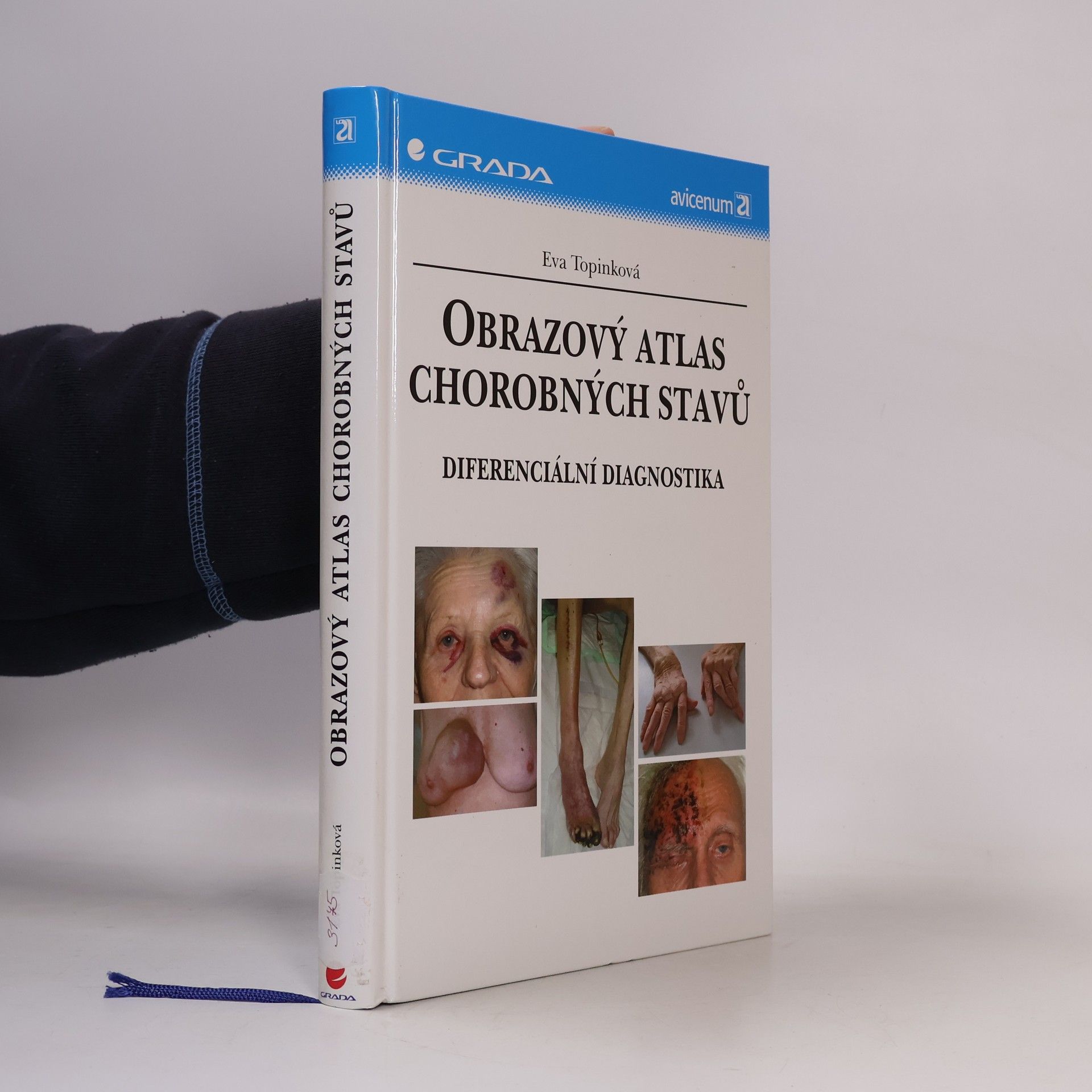Eva Topinková Obrazový atlas chorobných stavů : diferenciální diagnostika
