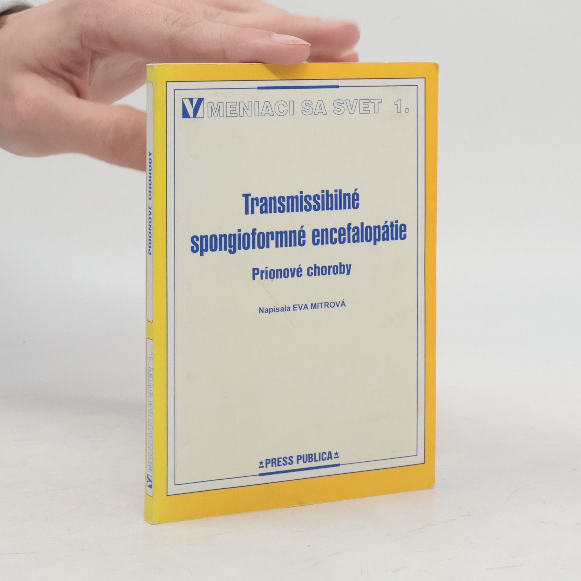 Eva Mitrová Transmissibilné spongioformné encefalopátie prionové choroby