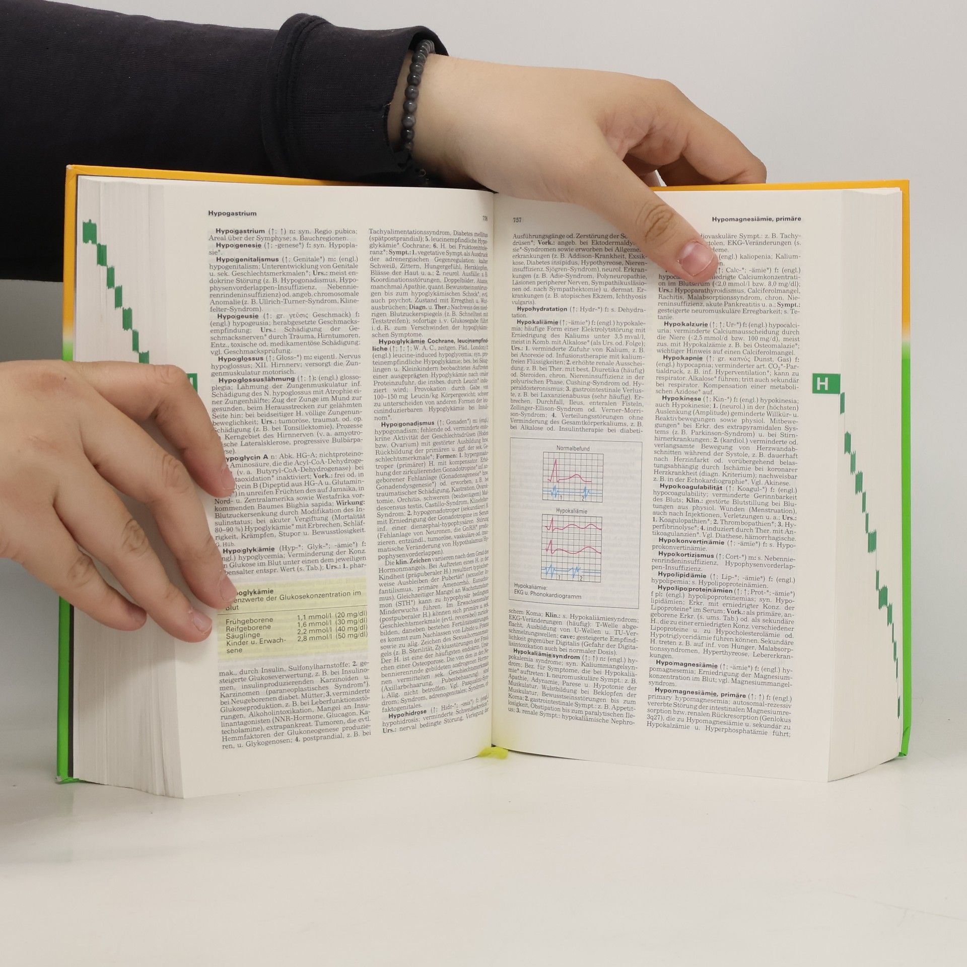 Autorenkollektiv Pschyrembel Klinisches Worterbuch
