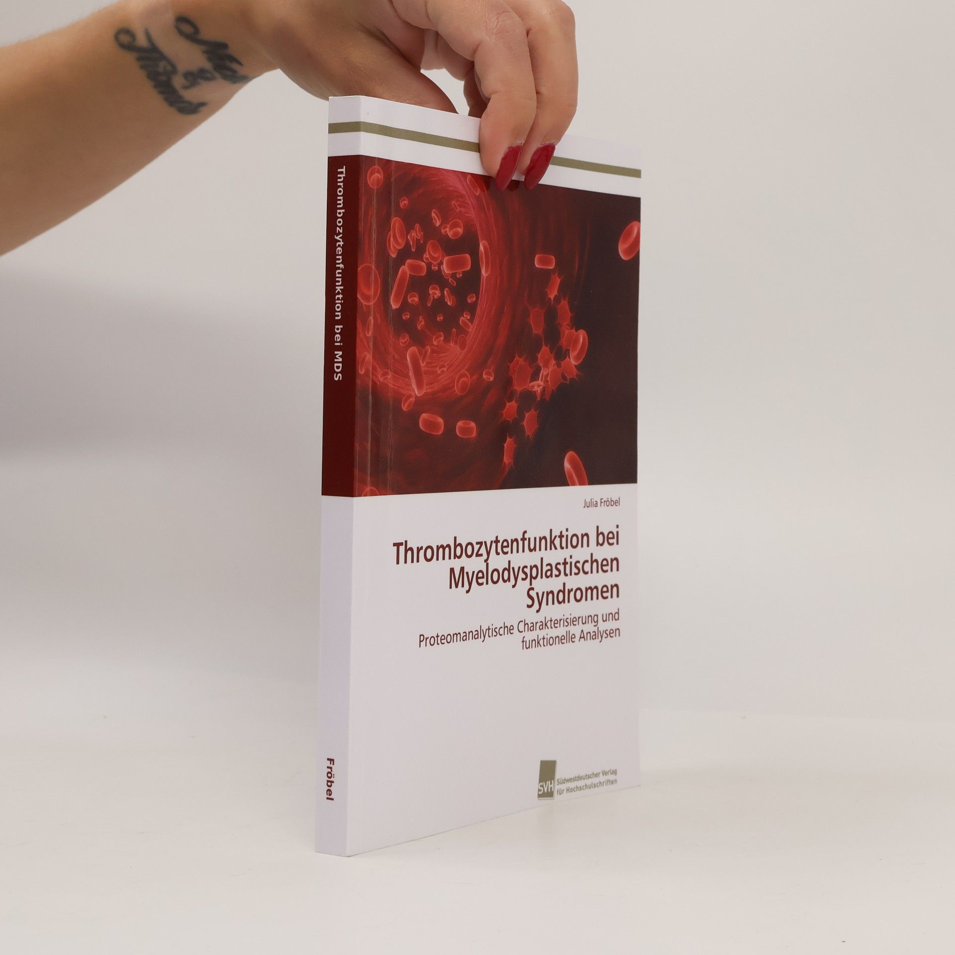 Julia Fröbel Thrombozytenfunktion bei Myelodysplastischen Syndromen