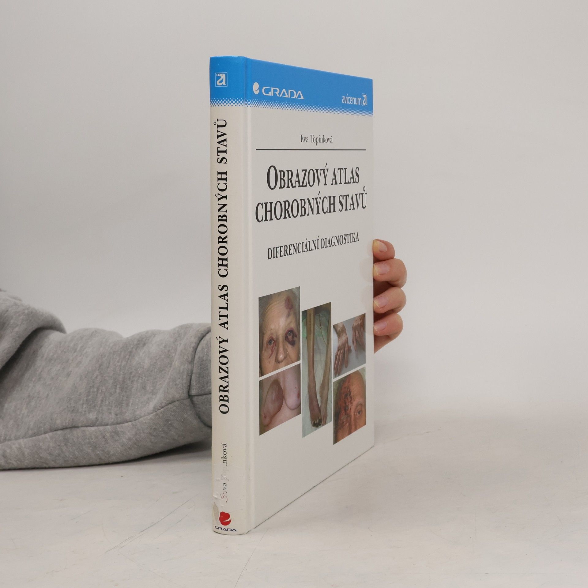 Obrazový atlas chorobných stavů : diferenciální diagnostika