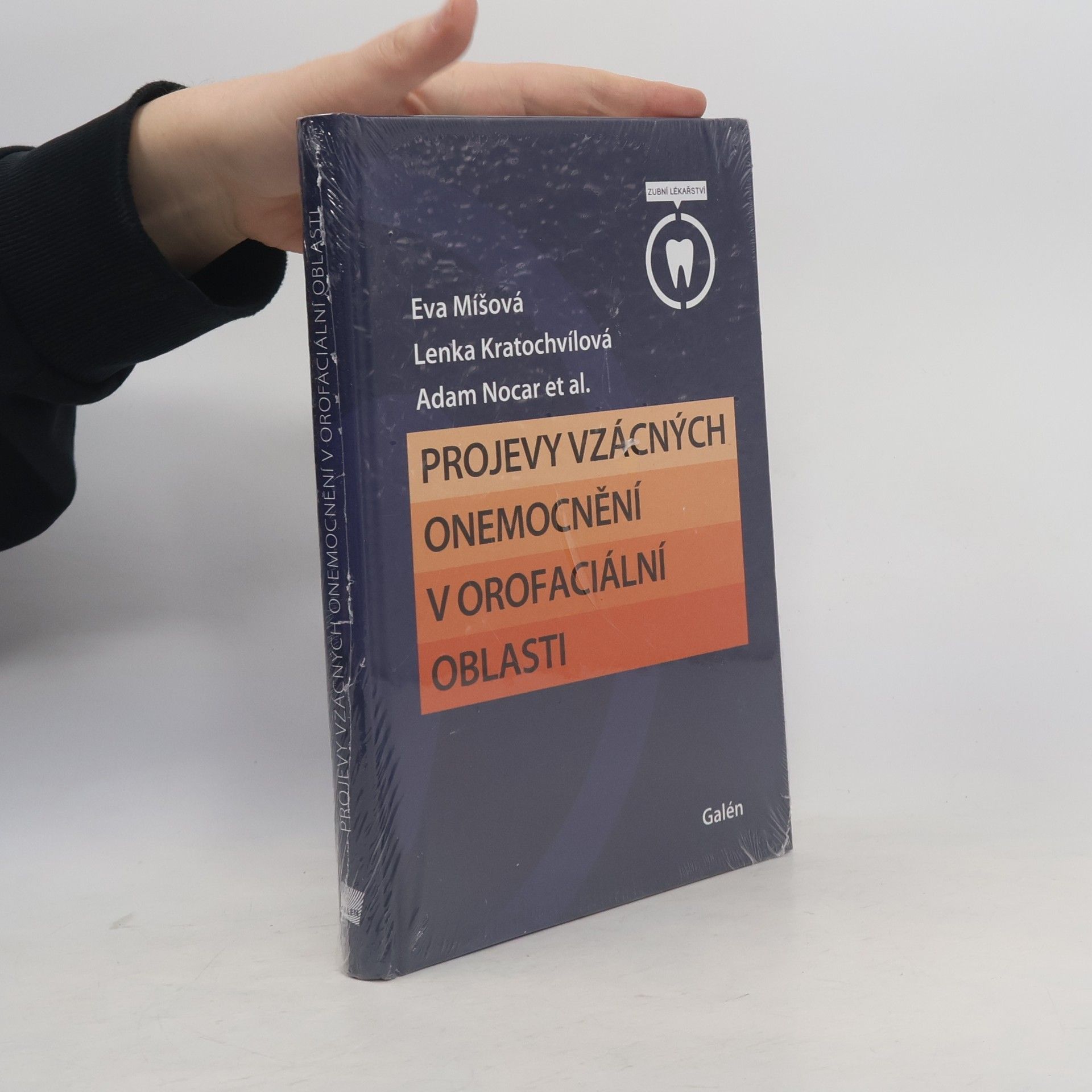 Adam Nocar Projevy vzácných onemocnění v orofaciální oblasti