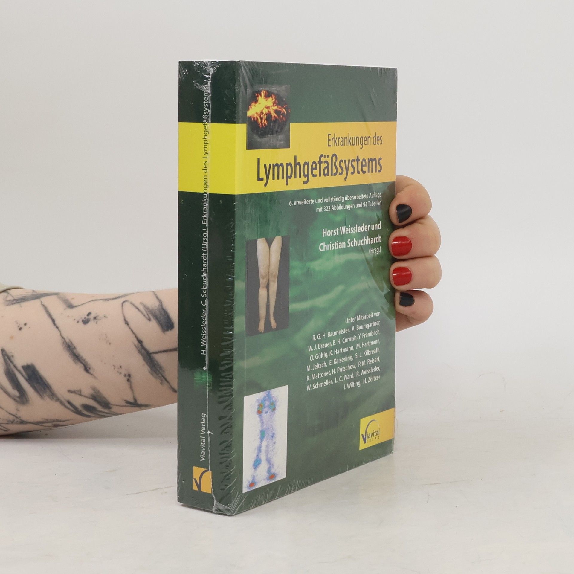 Erkrankungen des Lymphgefäßsystems