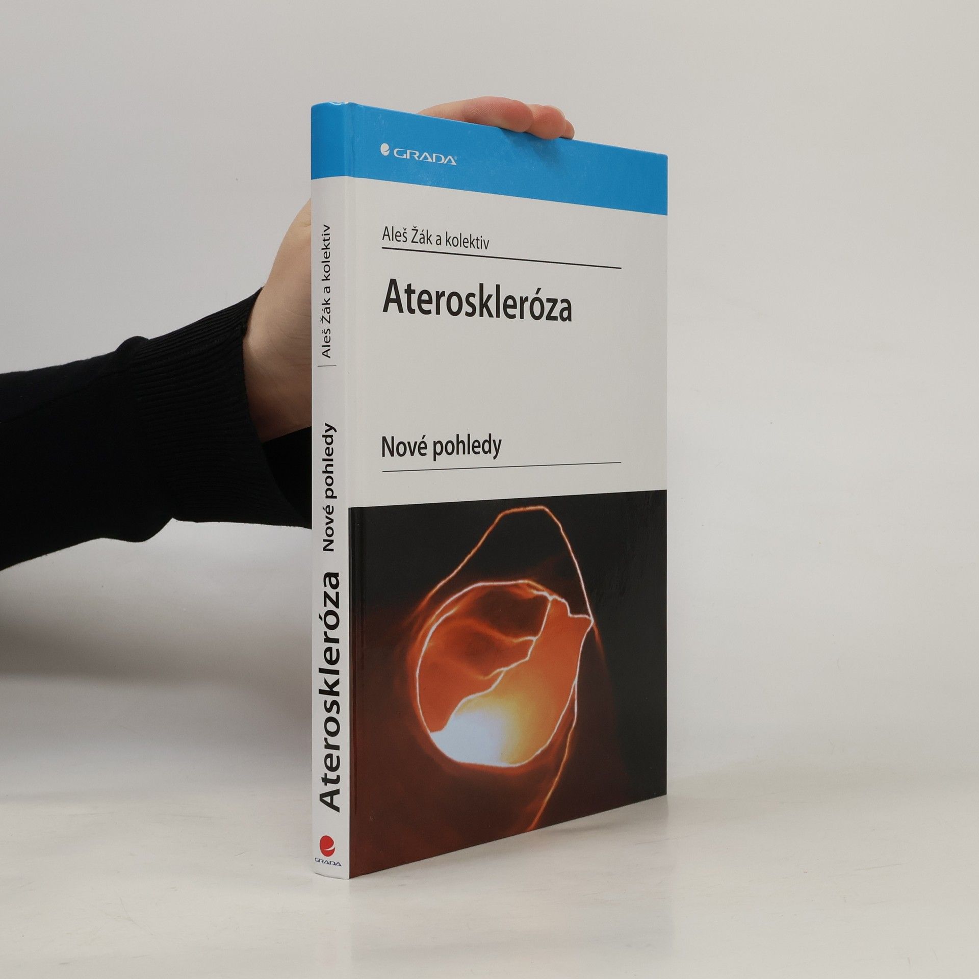 Aleš Žák Ateroskleróza - Nové pohledy