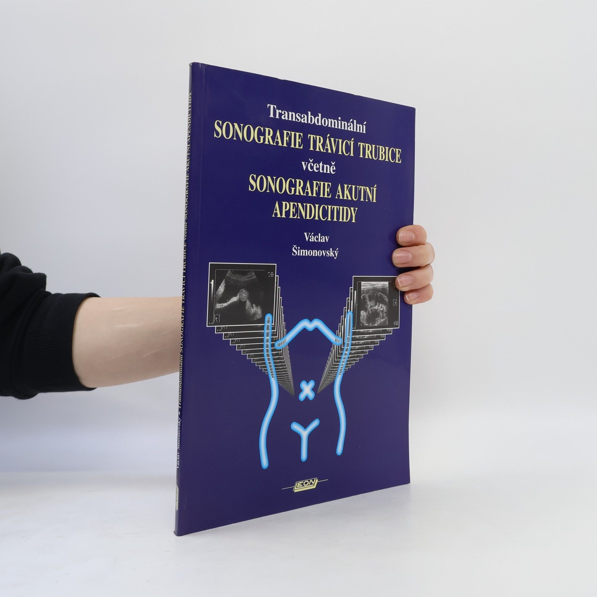 Václav Šimonovský Transabdominální sonografie trávicí trubice včetně sonografie akutní apendicitidy
