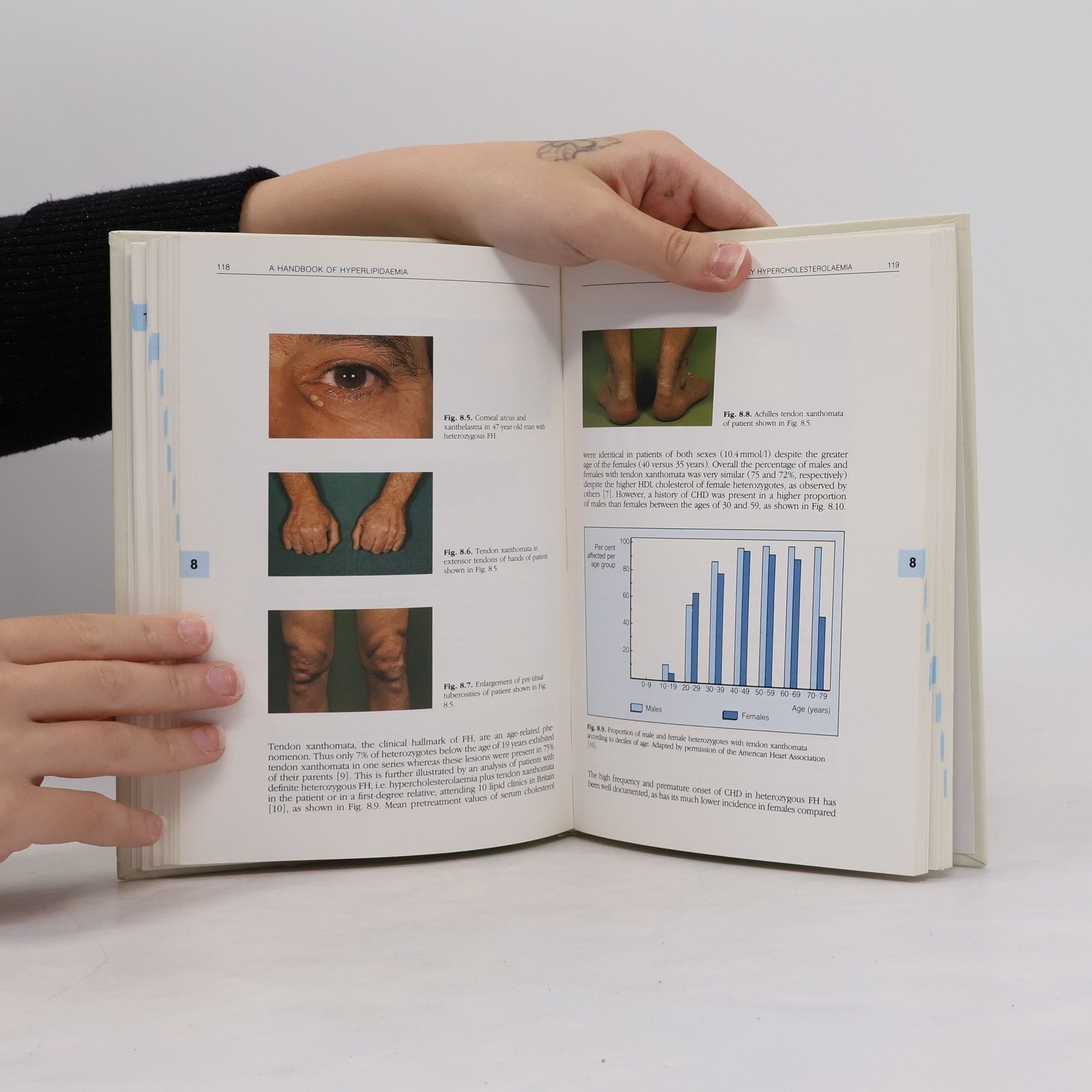 G. R. Thompson A Handbook of Hyperlipidaemia