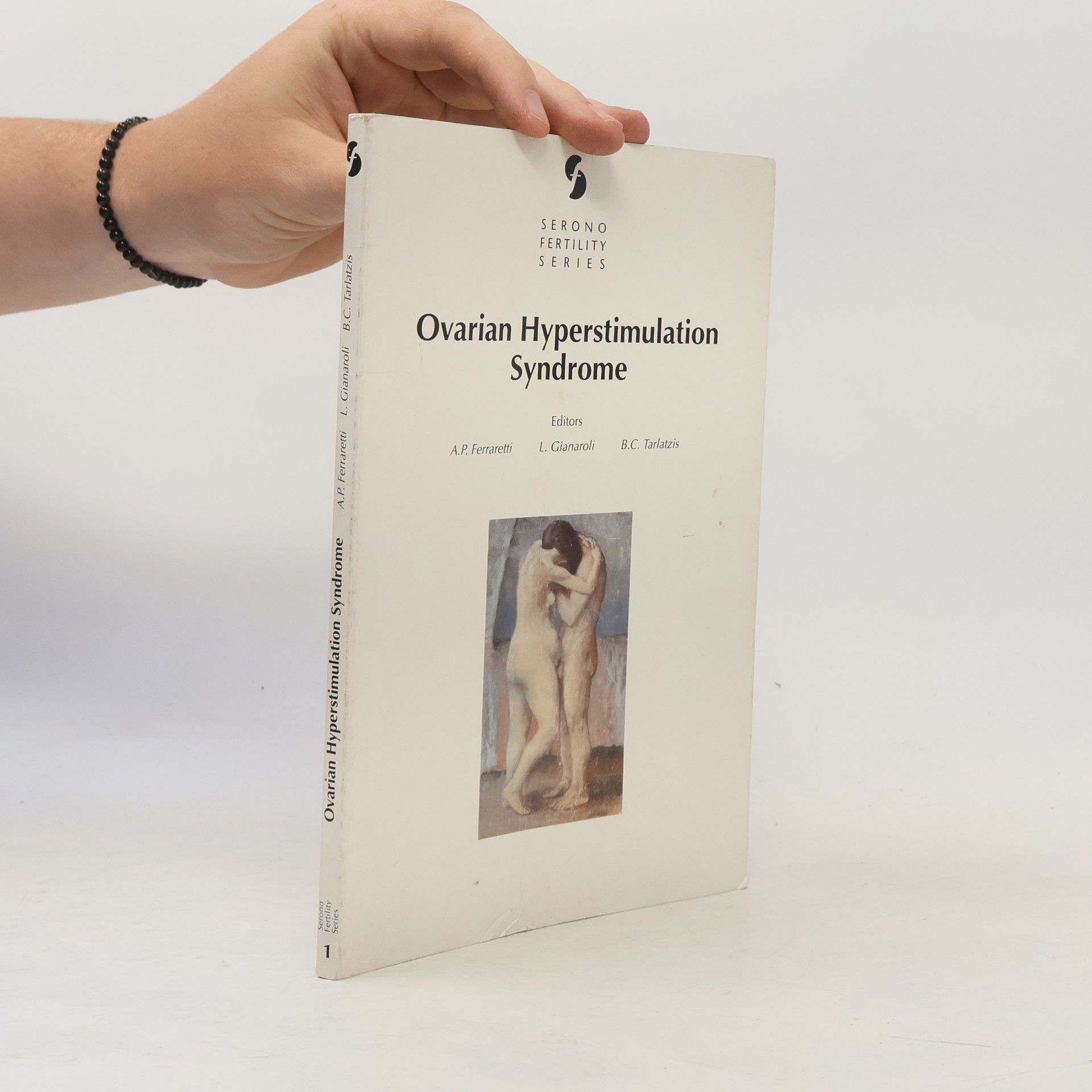Autorenkollektiv Ovarian Hyperstimulation Syndrome