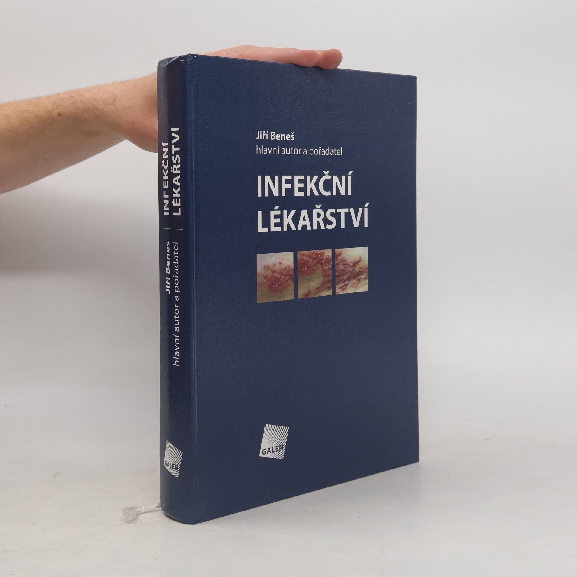 Jiří Beneš Infekční lékařství