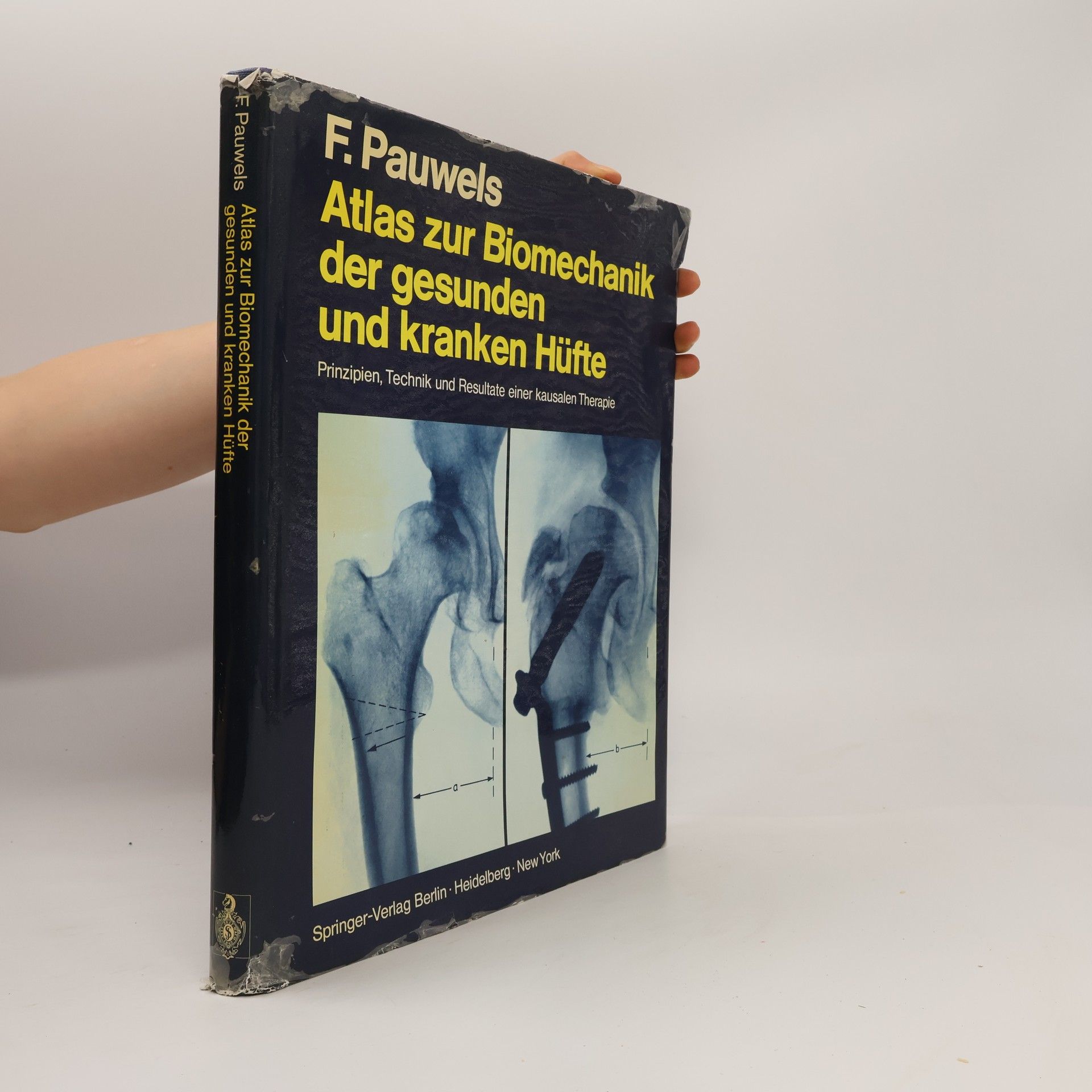 Atlas zur Biomechanik der gesunden und kranken Hüfte