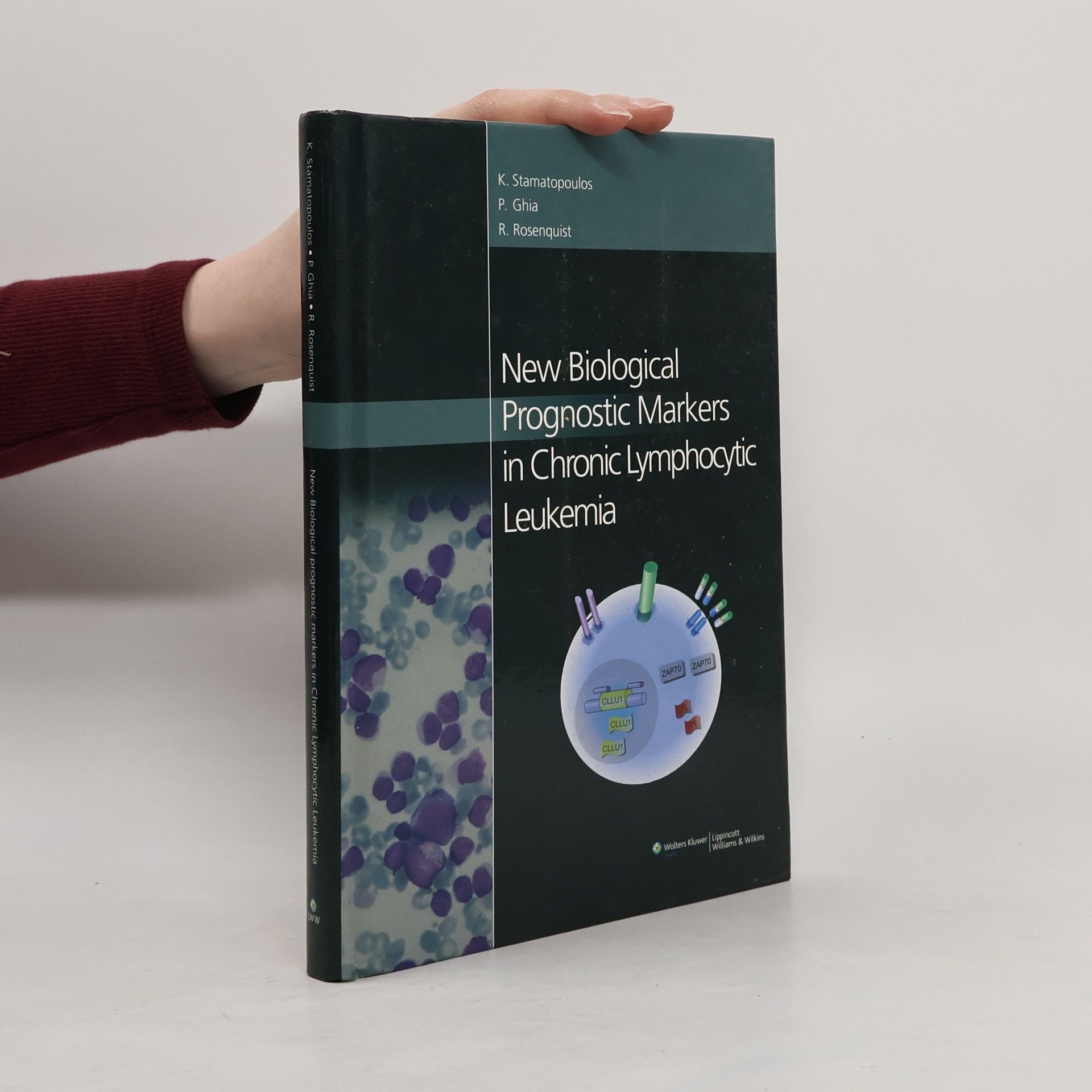 Richard Rosenquist New Biological Prognostic Markers in Chronic Lymphocytic leukemia