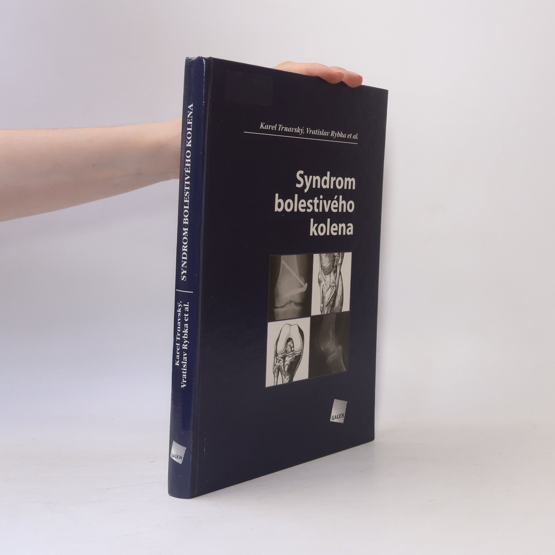 Vratislav Rybka Syndrom bolestivého kolena