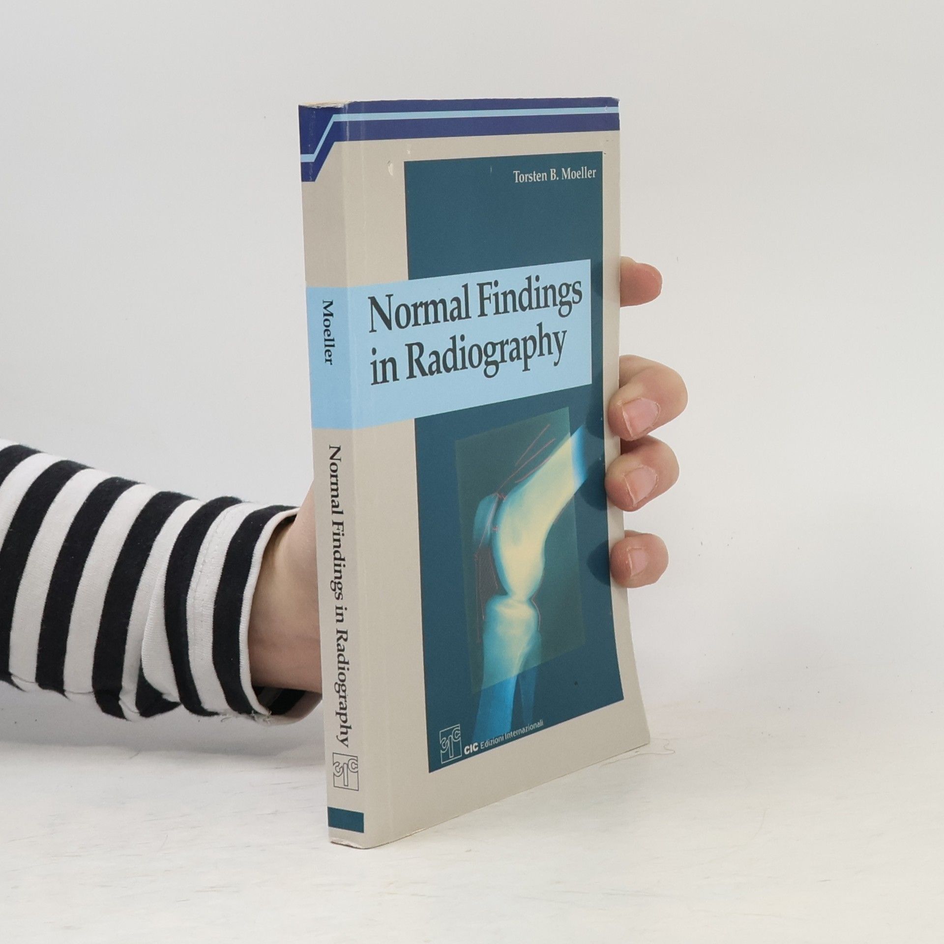 Torsten B. Moeller Normal Findings in Radiography