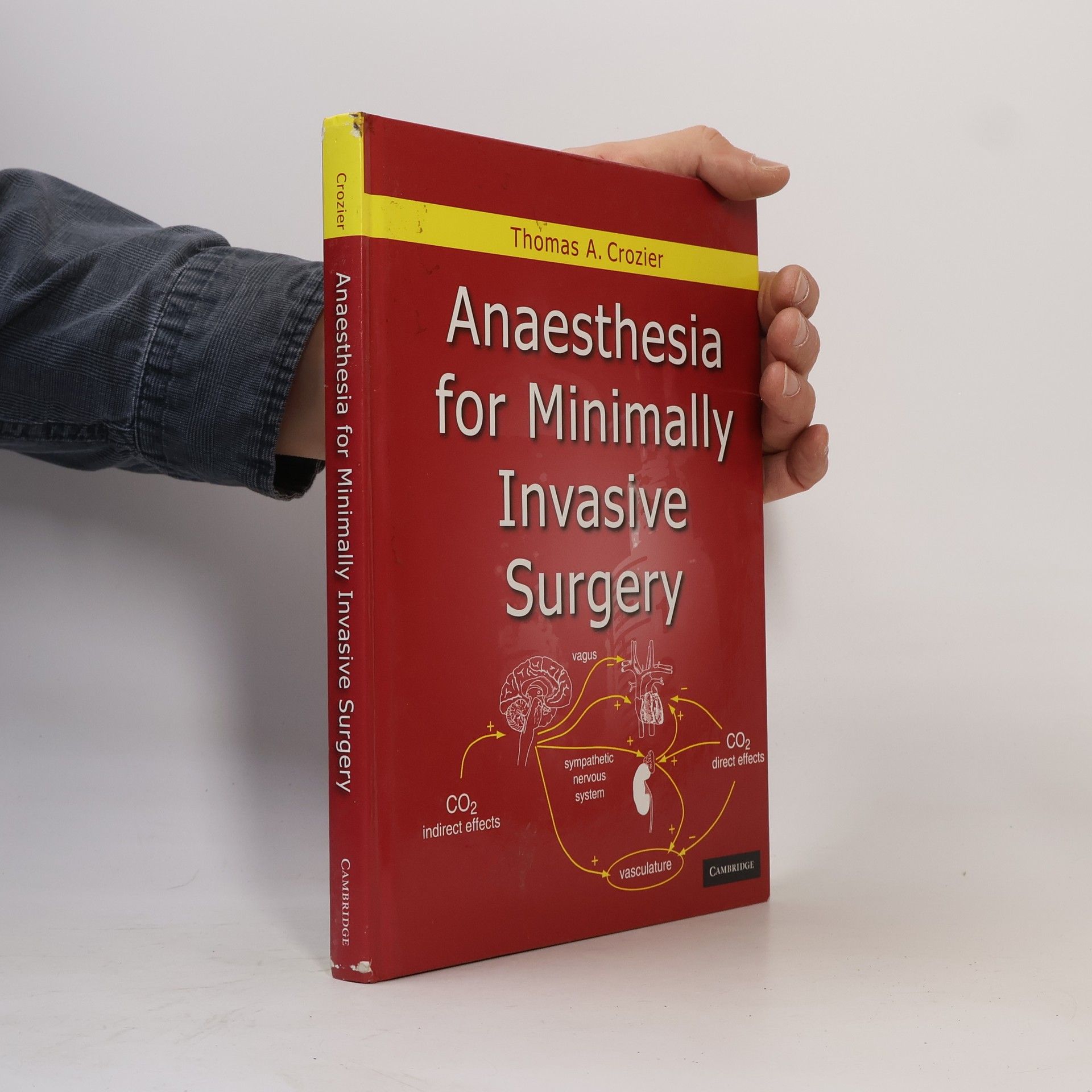 Thomas Allen Crozier Anaesthesia for Minimally Invasive Surgery