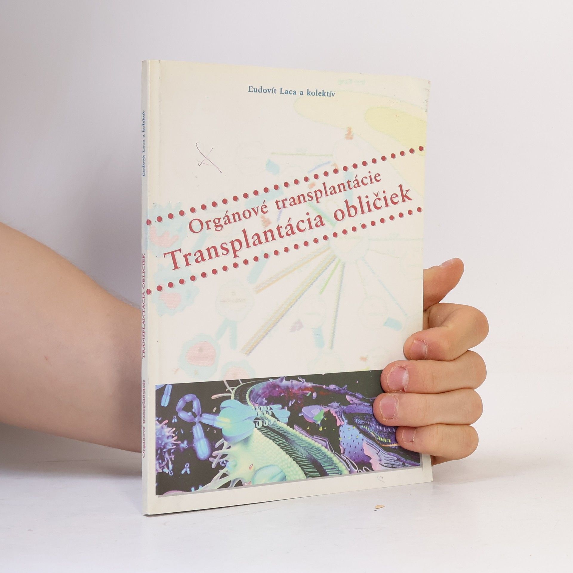 Collectif d'auteurs Orgánové transplantácie - Transplantácie obličiek