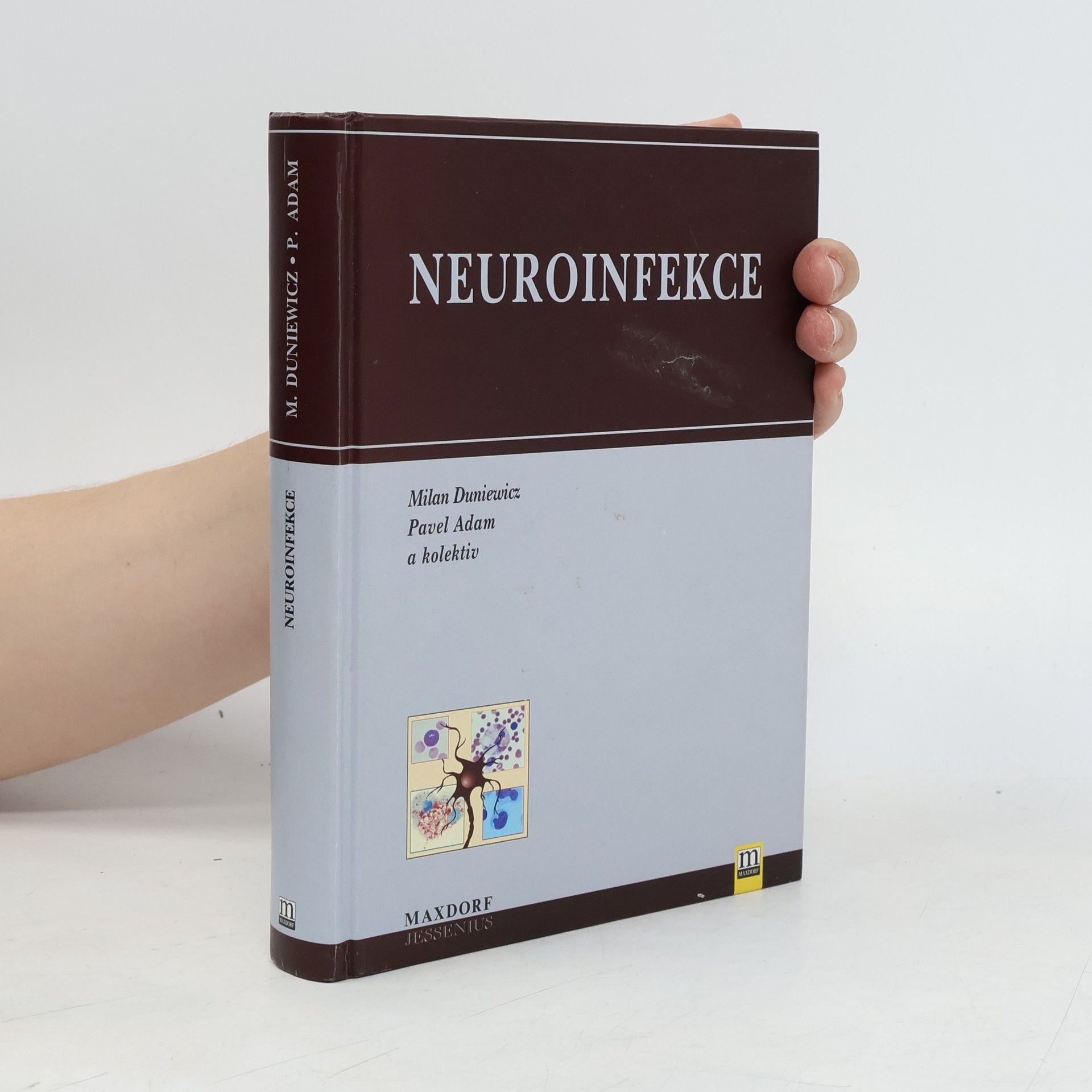 Auteurscollectief Neuroinfekce