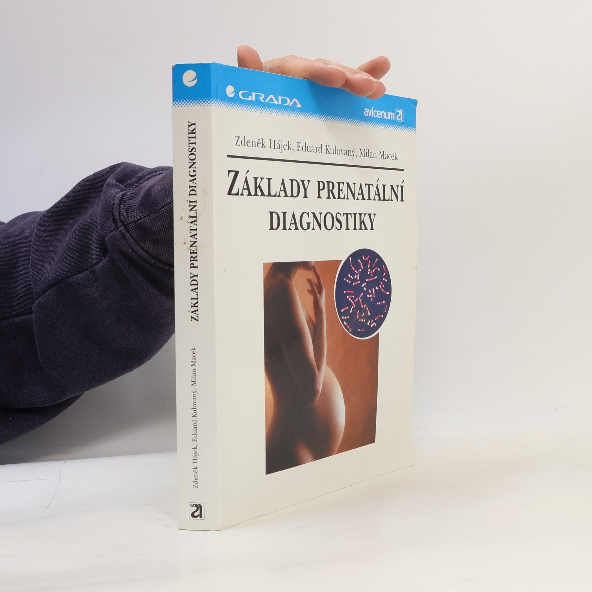Základy prenatální diagnostiky