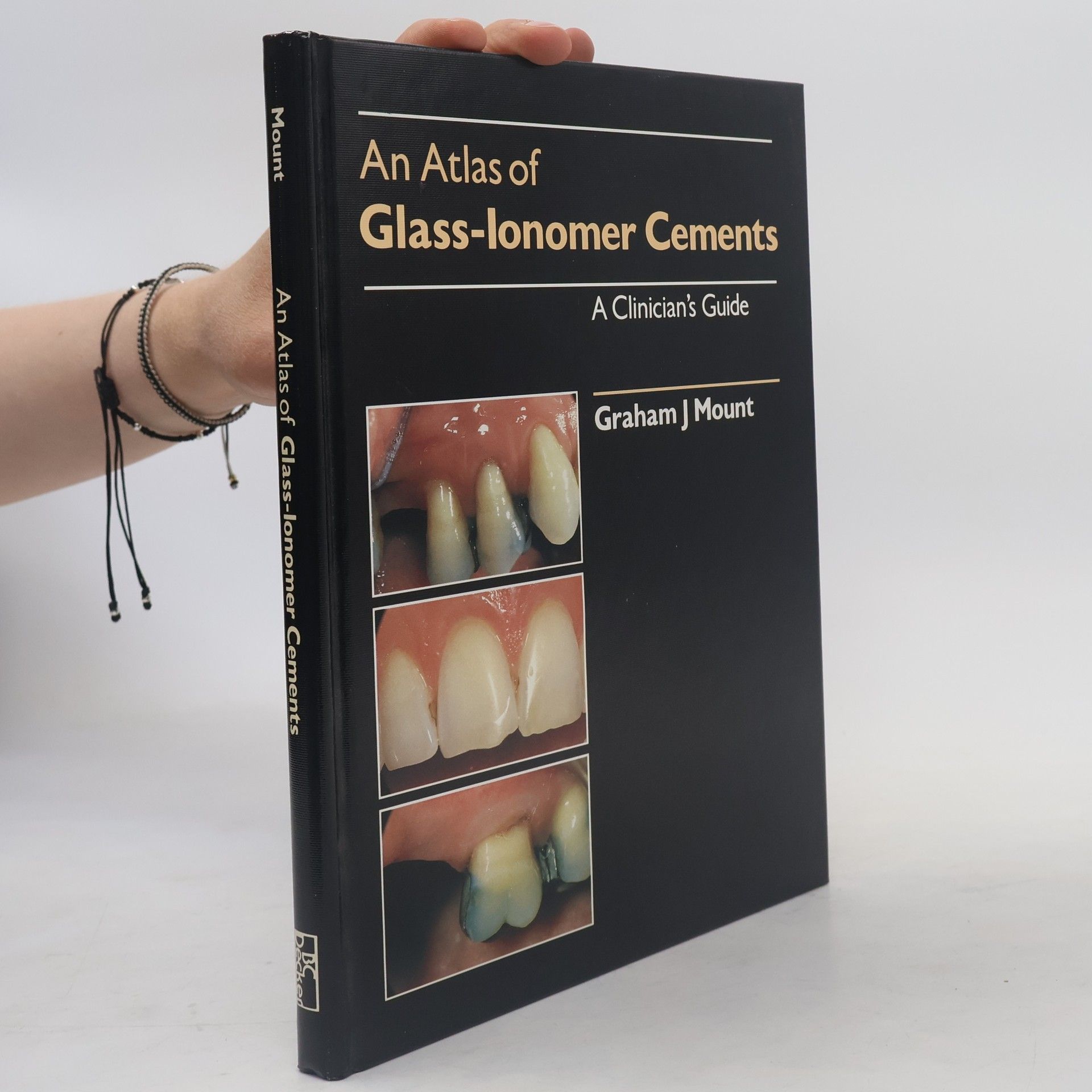 Graham J. Mount Clinical Techniques in Dentistry: An Atlas of Glass-Ionomer Cements