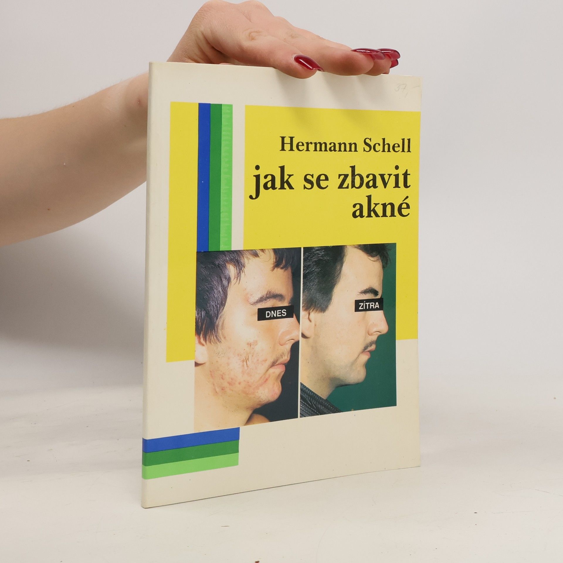 Hermann Schell Jak se zbavit akné