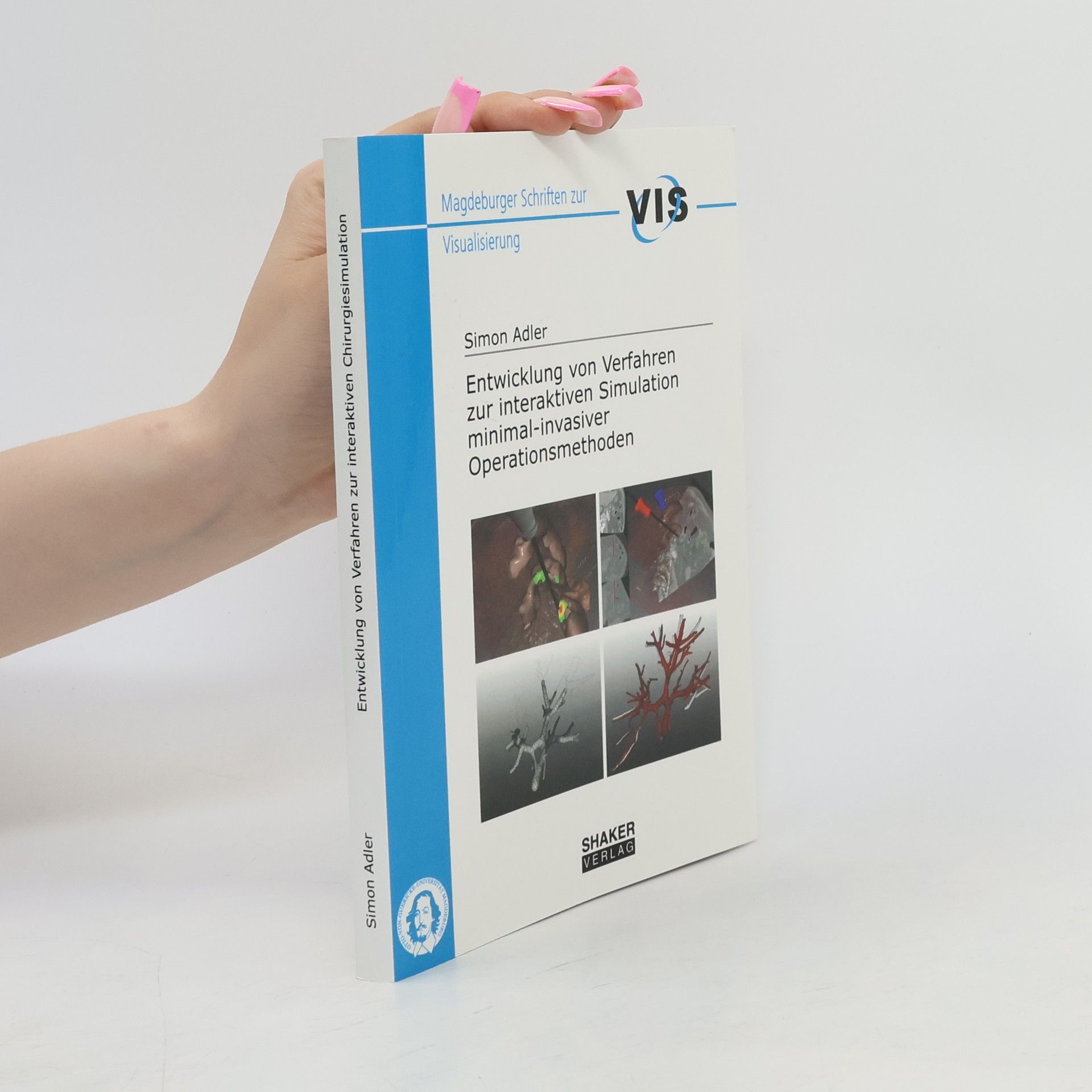 Simon Adler Magdeburger Schriften zur Visualisierung: Entwicklung von Verfahren zur interaktiven Simulation minimal-invasiver Operationsmethoden