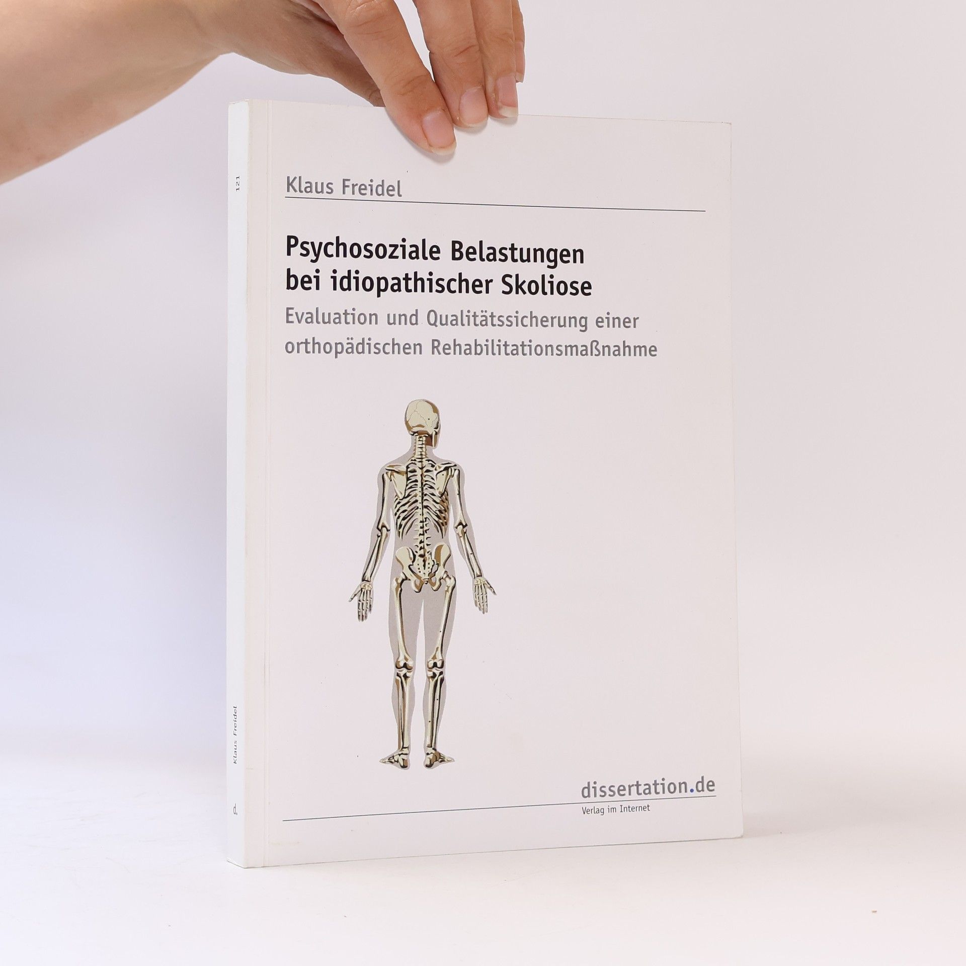 Klaus Freidel Psychosoziale Belastungen bei idiopathischer Skoliose