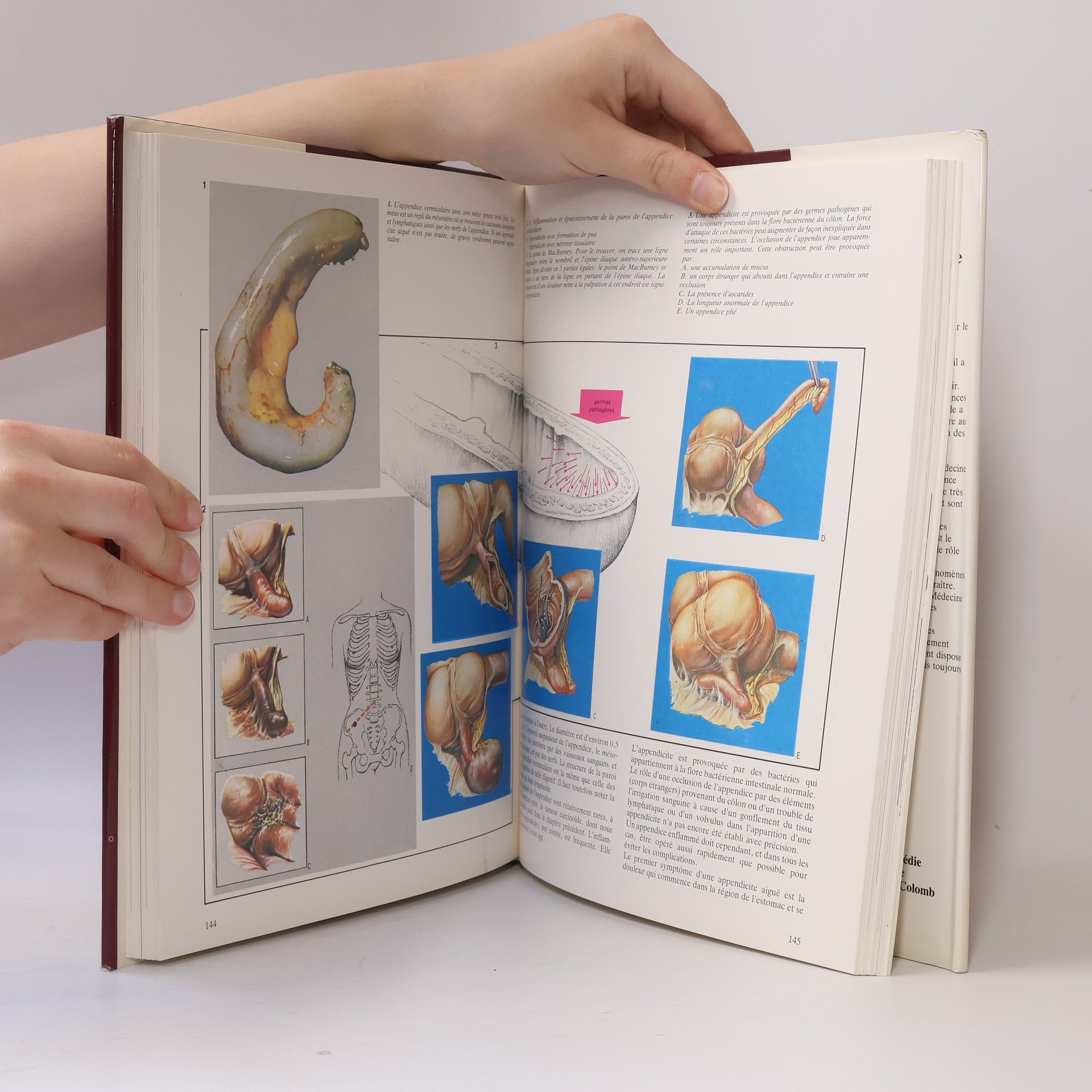 Nouvelle encyclopédie de la médecine: La Digestion
