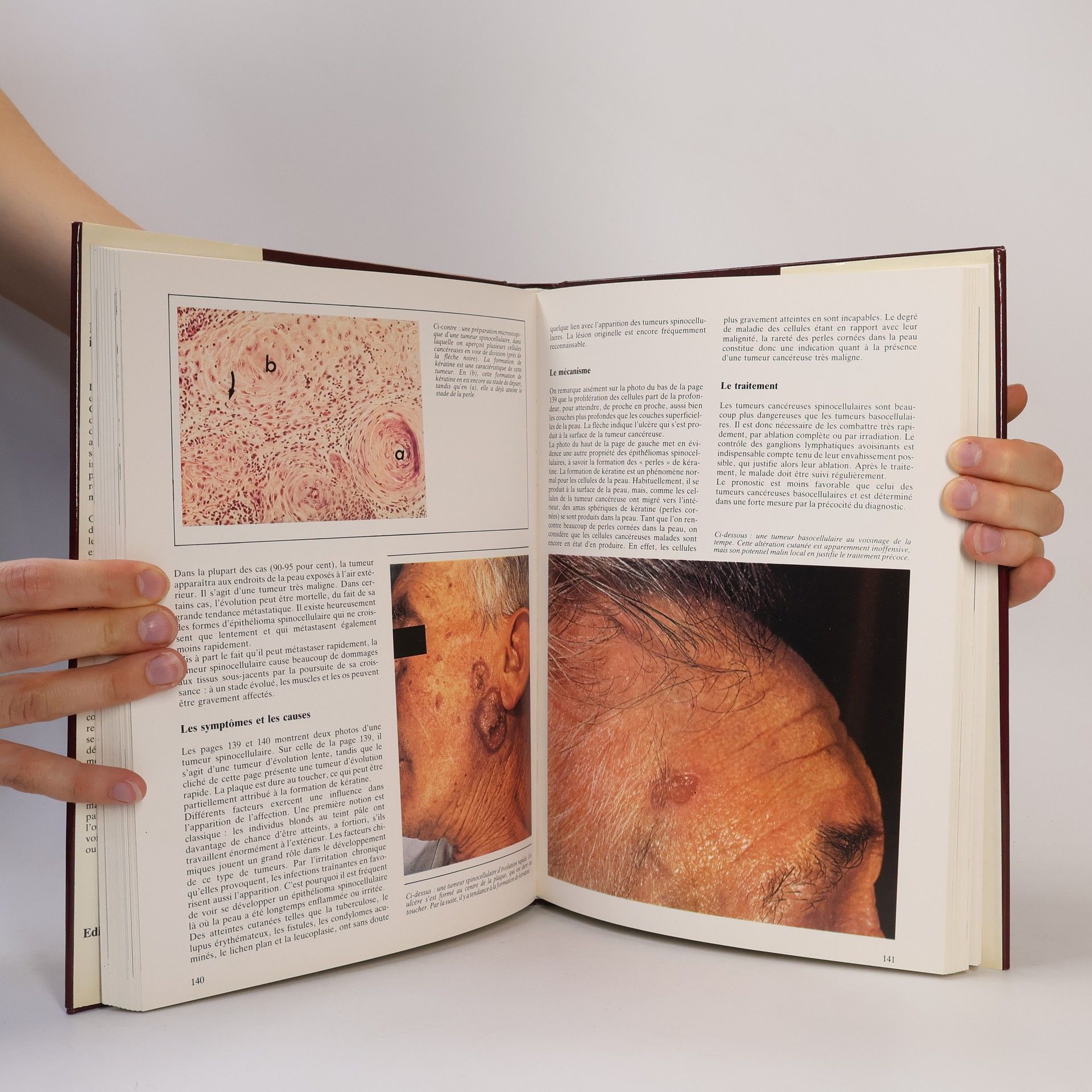 Nouvelle Encyclopédie de la médecine: La peau et les maladies infectieuses