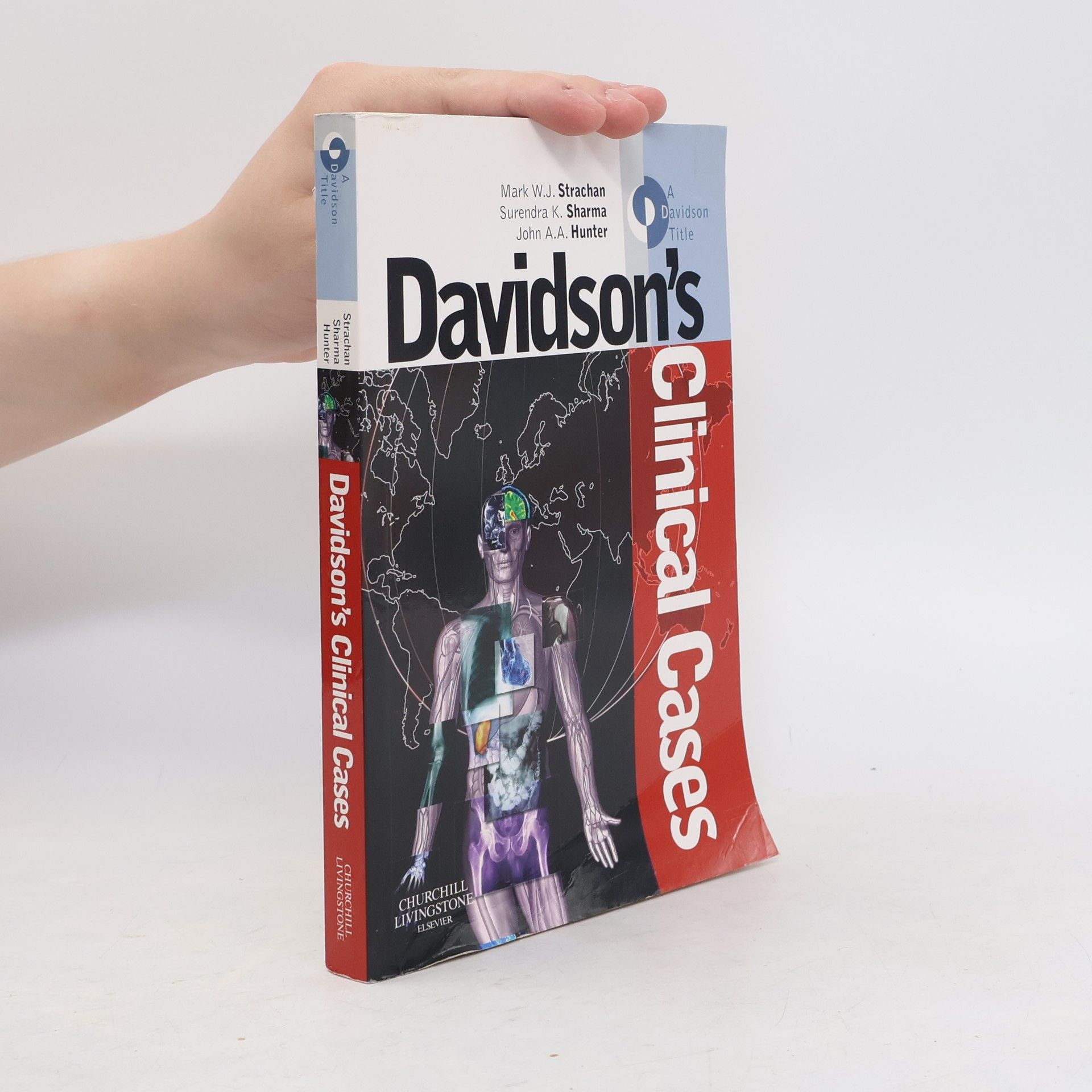 S. K. Surendra K. Sharma Davidson's Clinical Cases