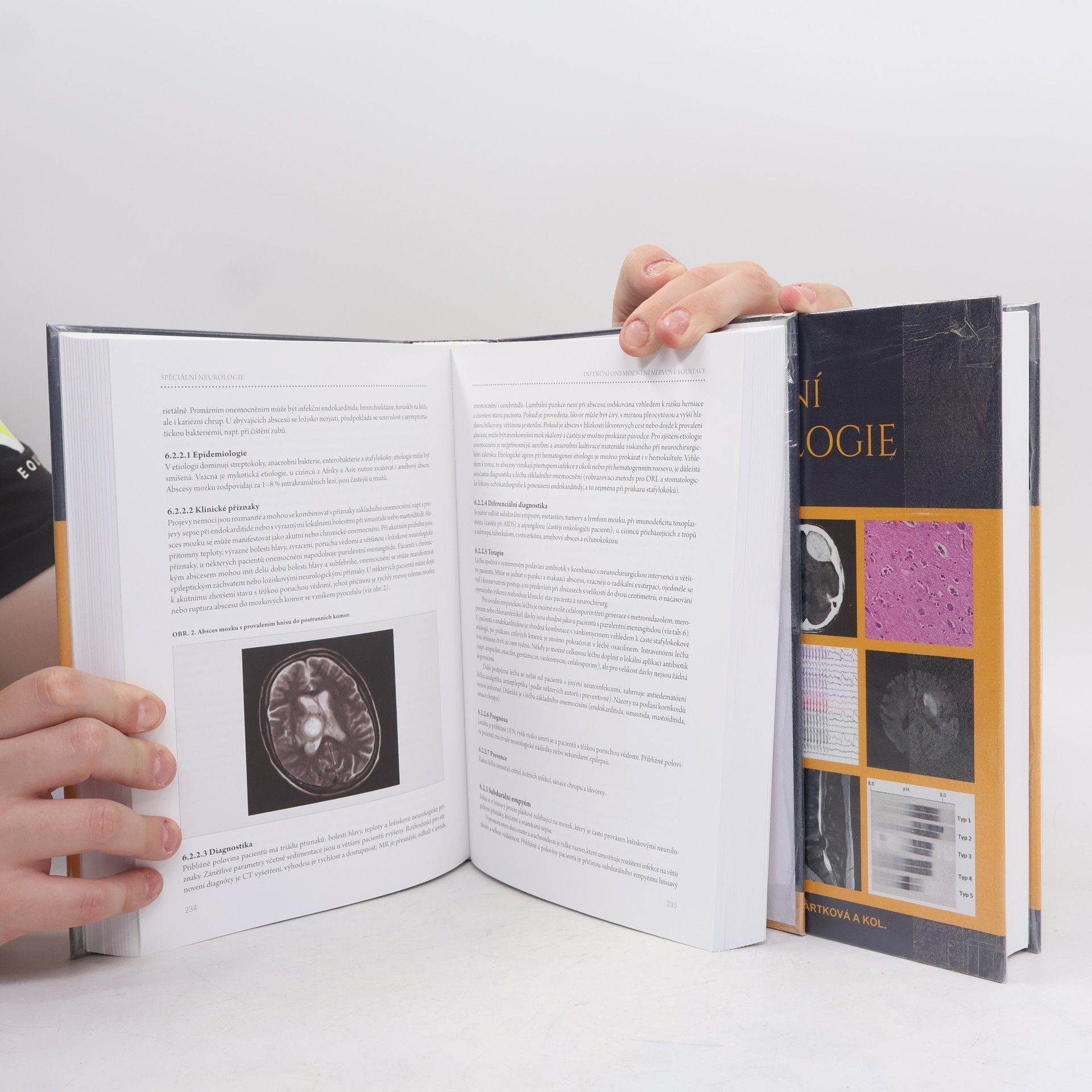 Petr Kaňovský Speciální neurologie