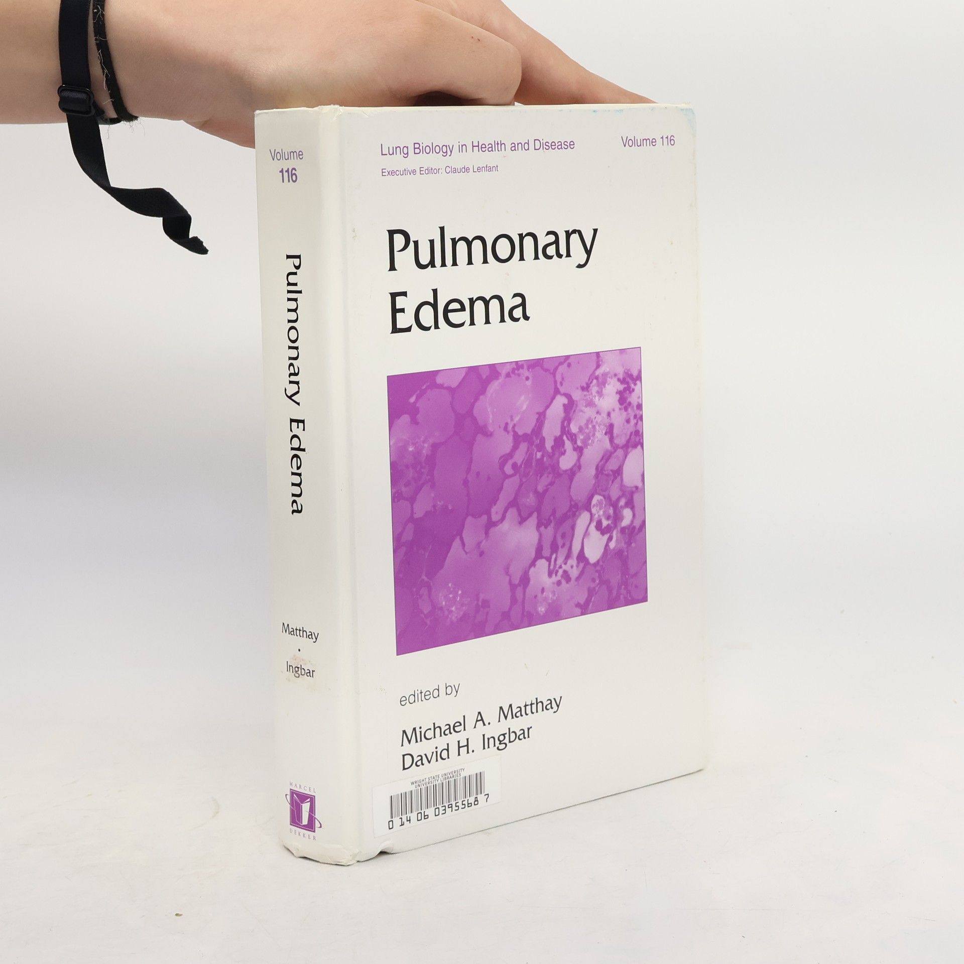 Lung Biology in Health and Disease - 116: Pulmonary Edema
