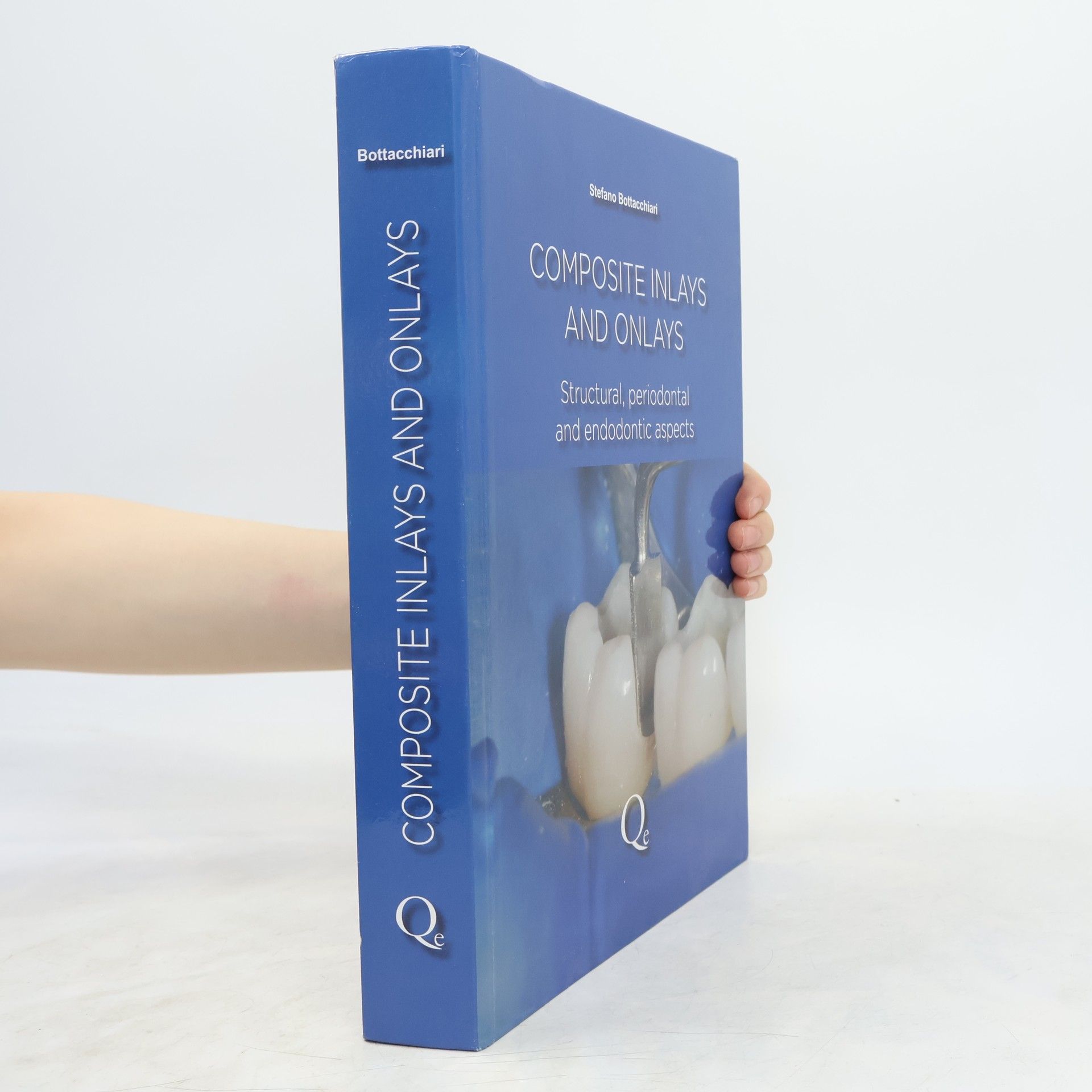 Stefano Bottacchiari Composite Inlays and Onlays: Structural, Periodontal, and Endodontic Aspects