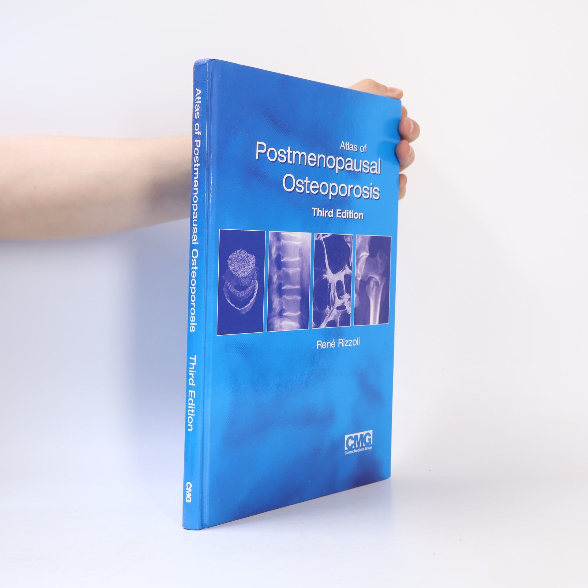 René Rizzoli Atlas of postmenopausal osteoporosis