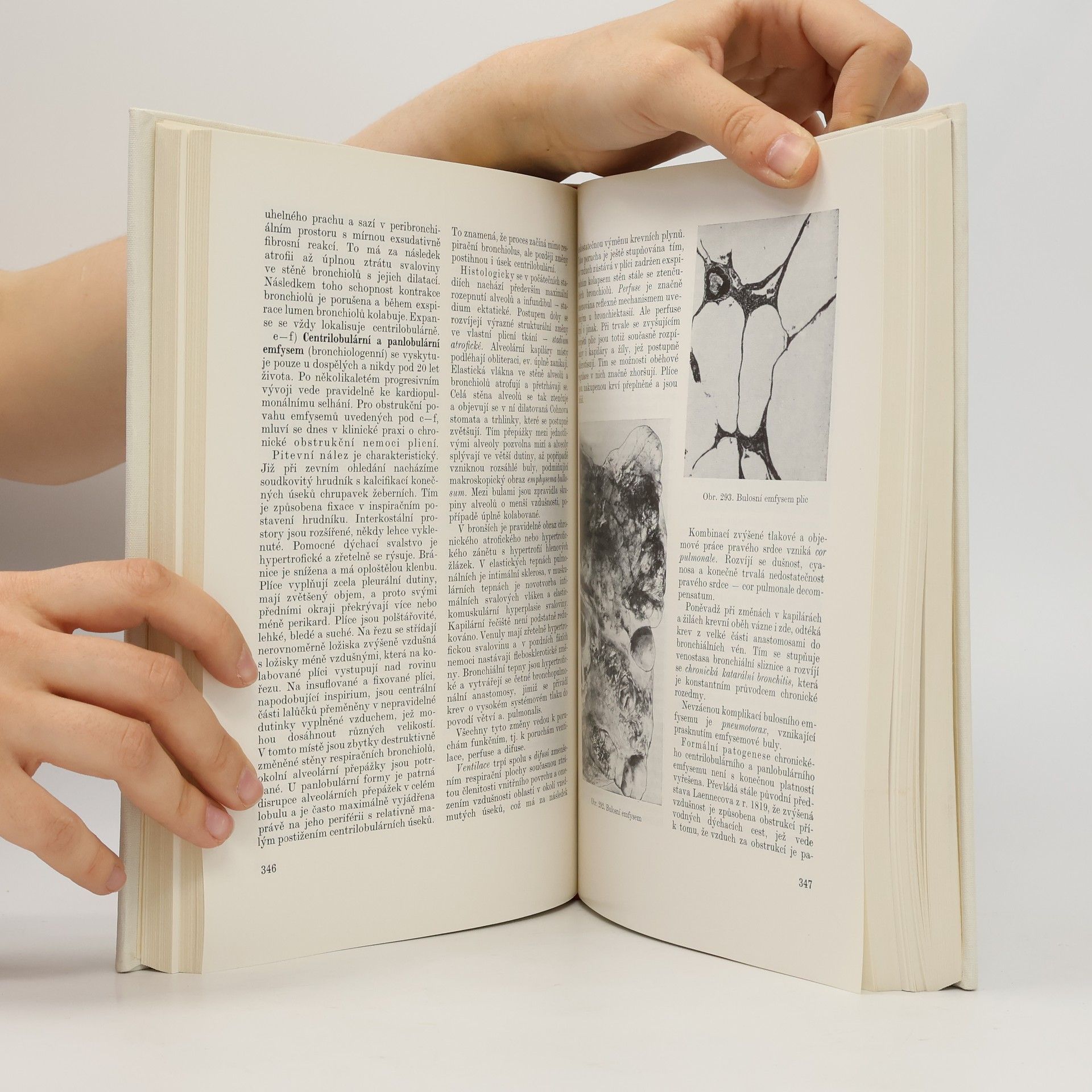 Blahoslav Bednář Učebnice patologické anatomie