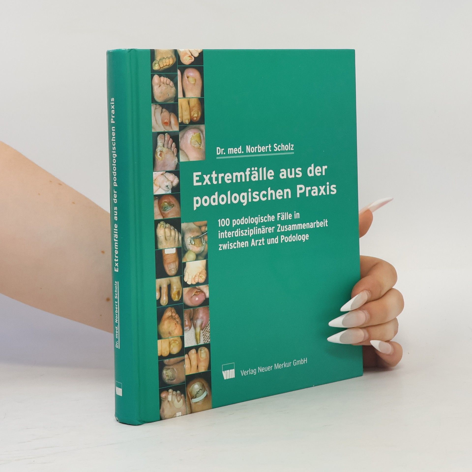 Dr. med. Norbert Scholz Extremfälle aus der podologischen Praxis