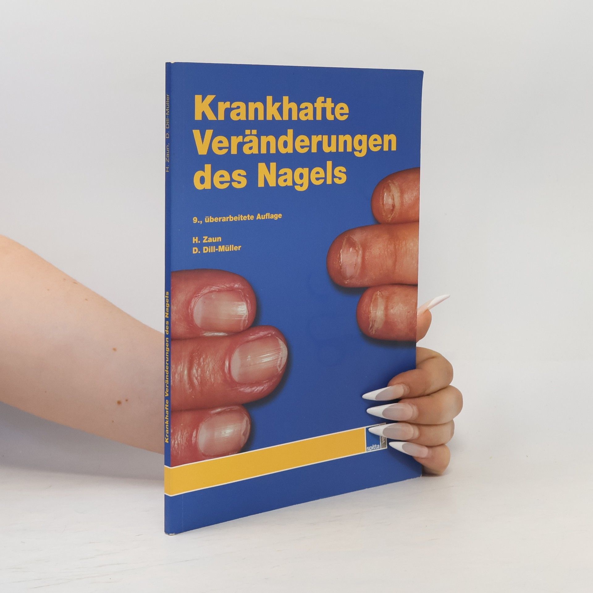 Dorothee Dill-Müller Krankhafte Veränderungen des Nagels