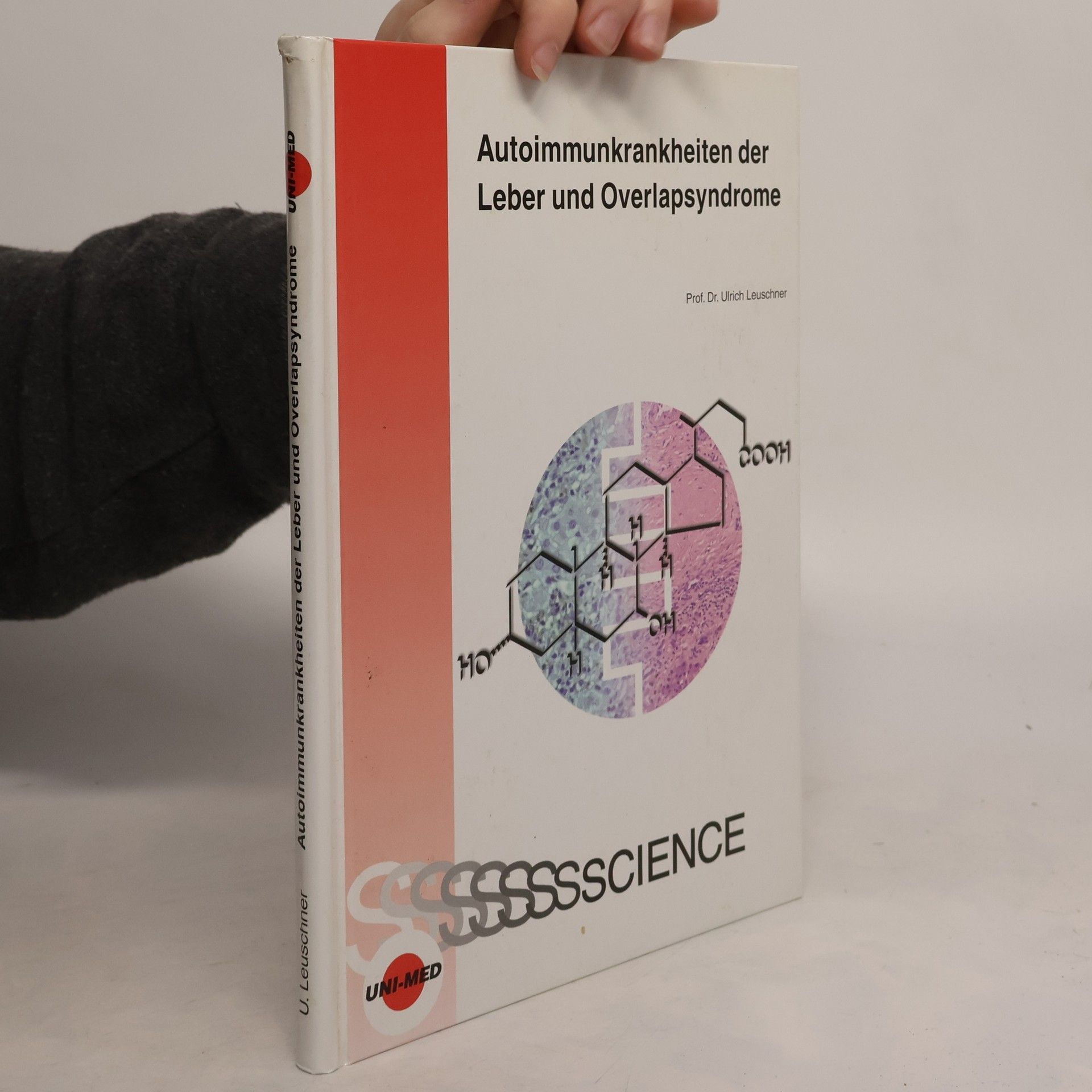 Autoimmunerkrankheiten der Leber und Overlapsyndrome