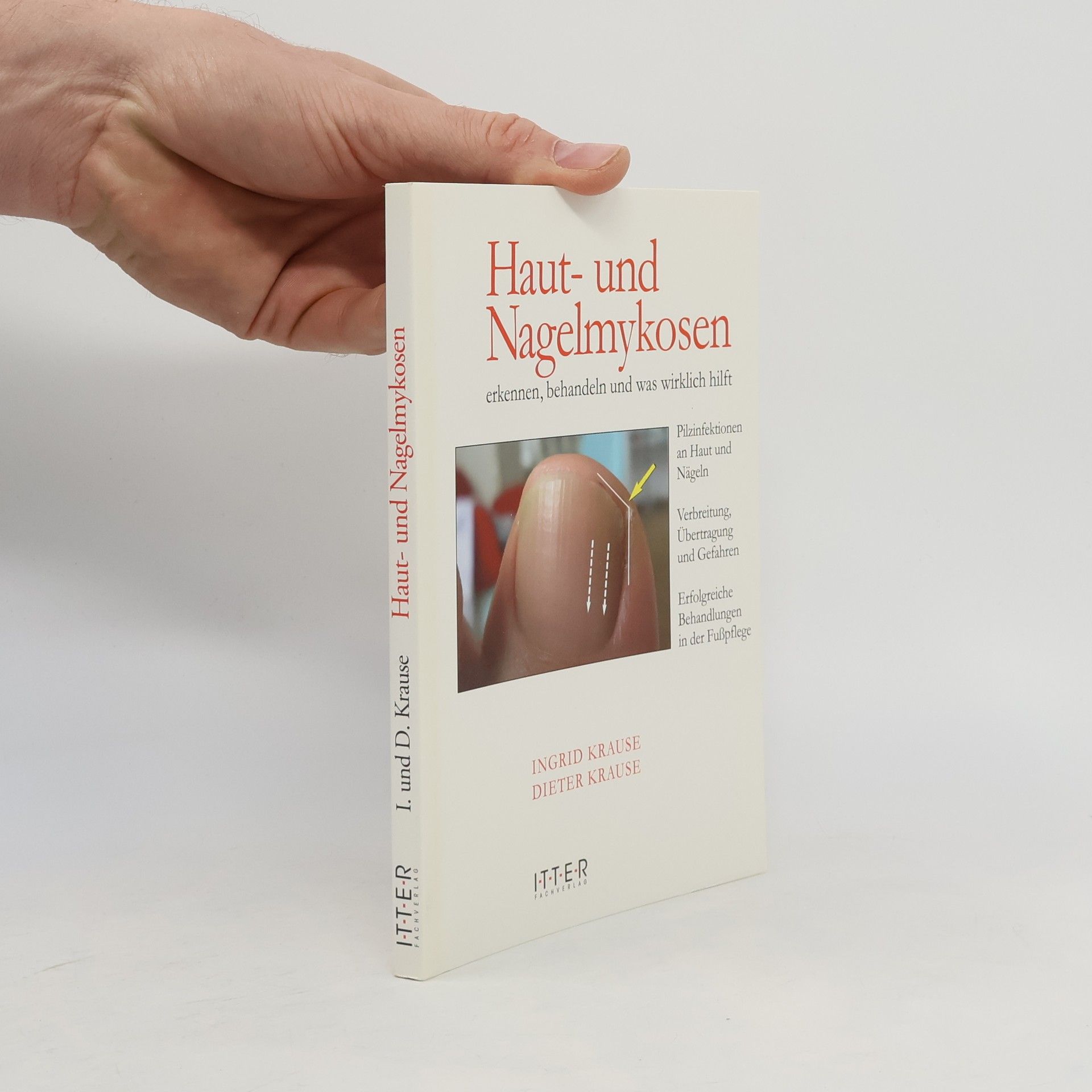 Ingrid Krause Haut- und Nagelmykosen