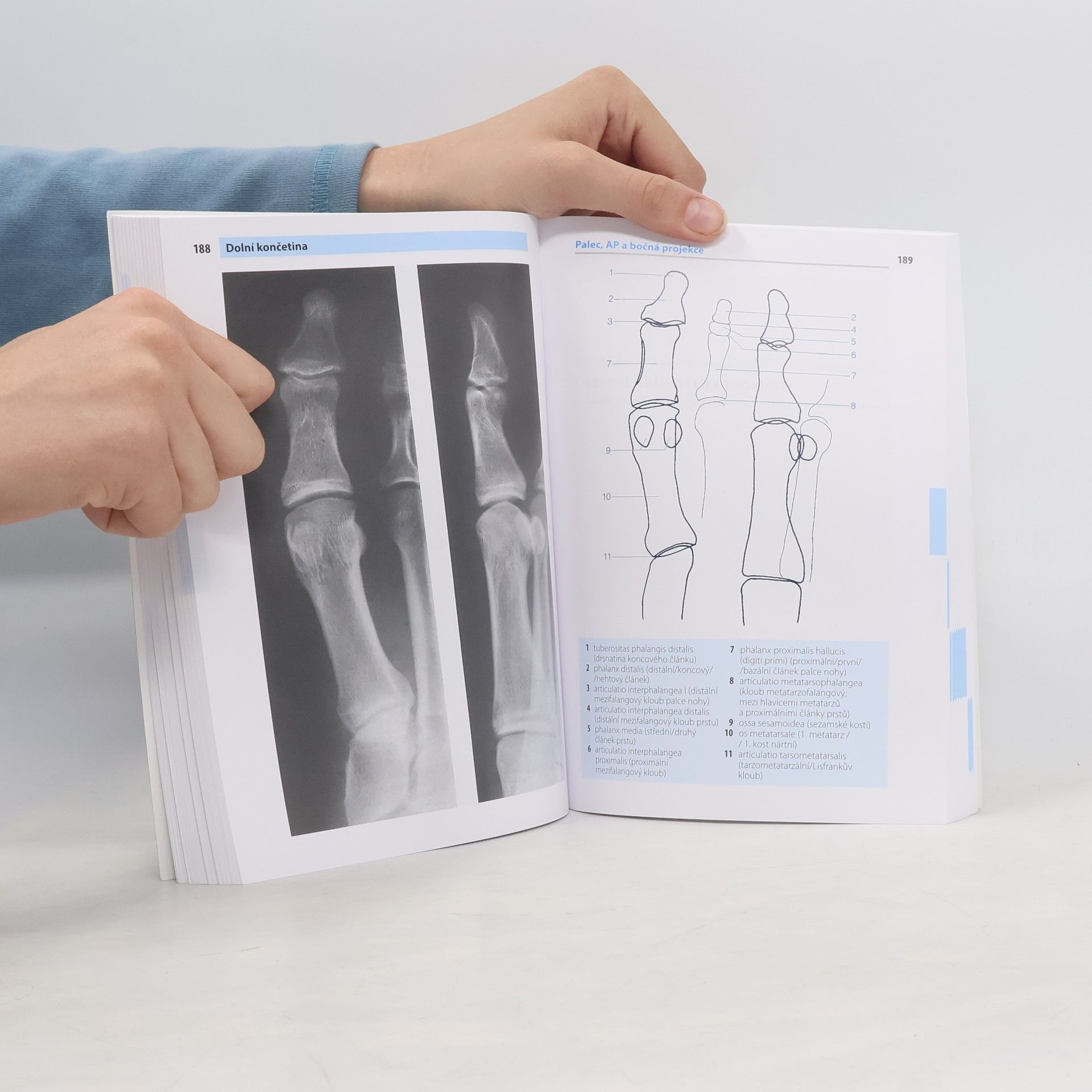 Torsten B. Möller Kapesní atlas rentgenové anatomie