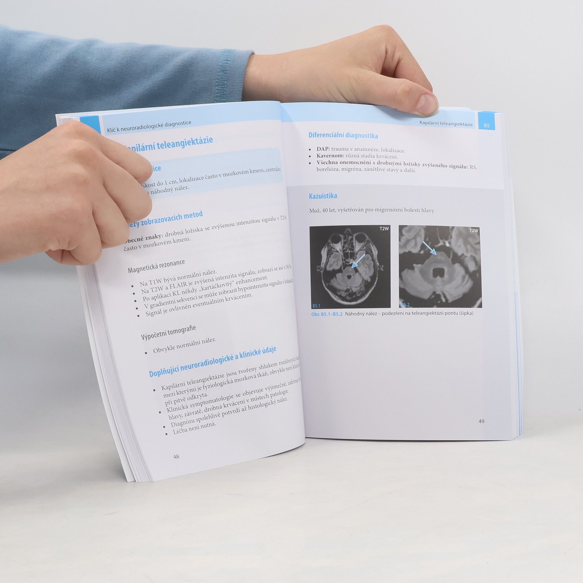 Zdeněk Seidl Klíč k neuroradiologické diagnostice