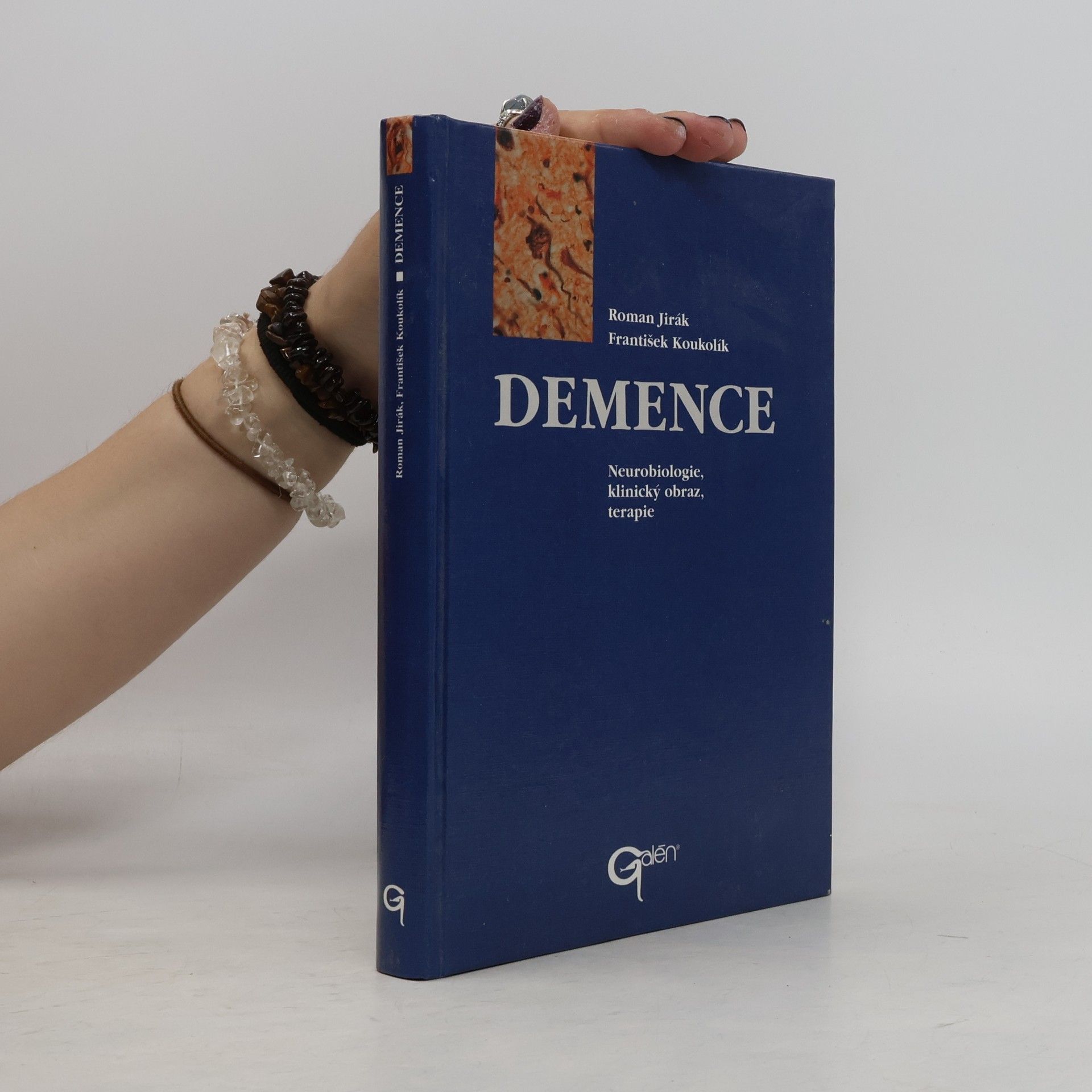 Demence : neurobiologie, klinický obraz, terapie