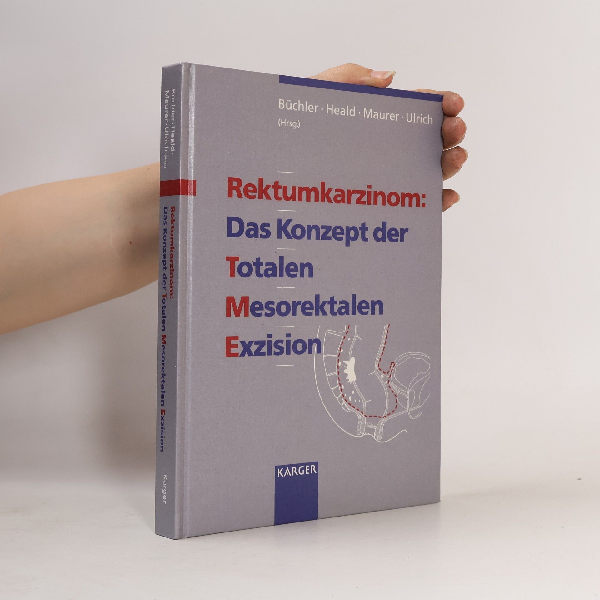 B. Ulrich Rektumkarzinom