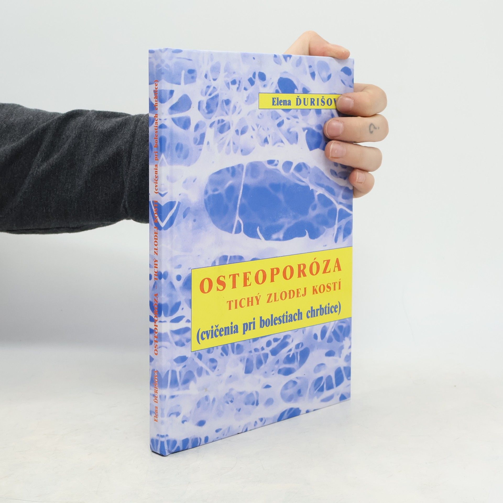 Osteoporóza. Tichý zlodej kostí