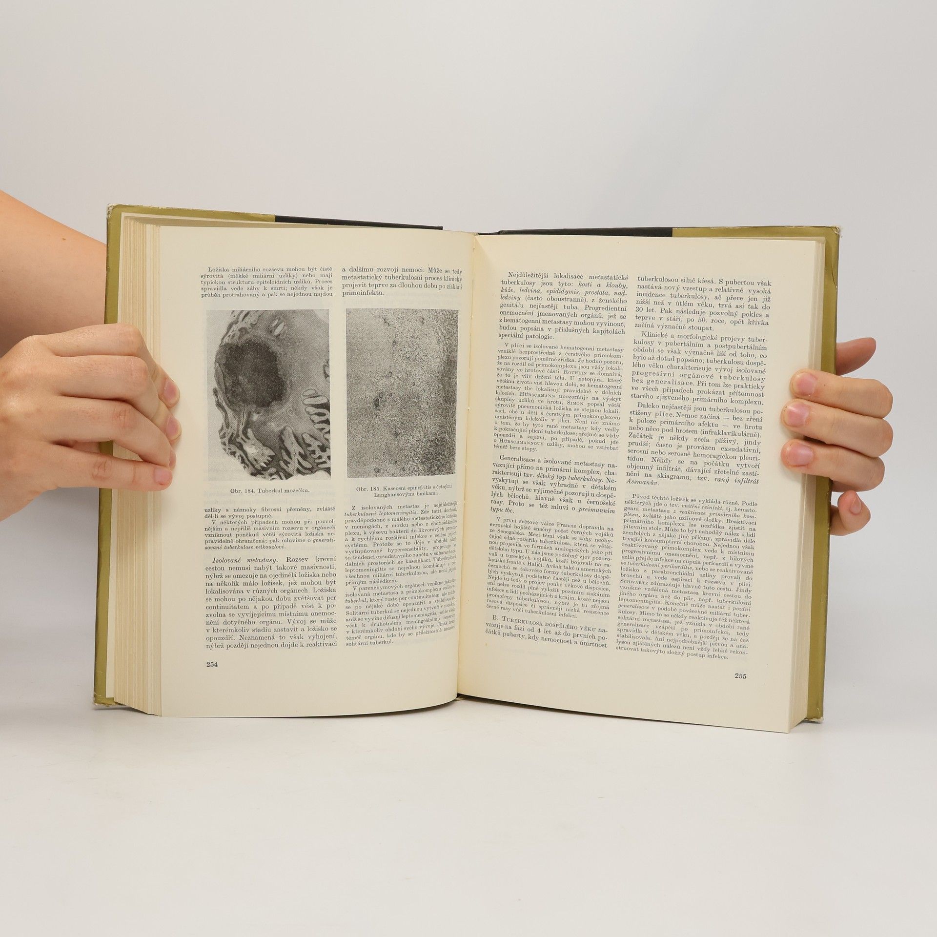 B. Bednář Patologická anatomie díl I. - část obecná
