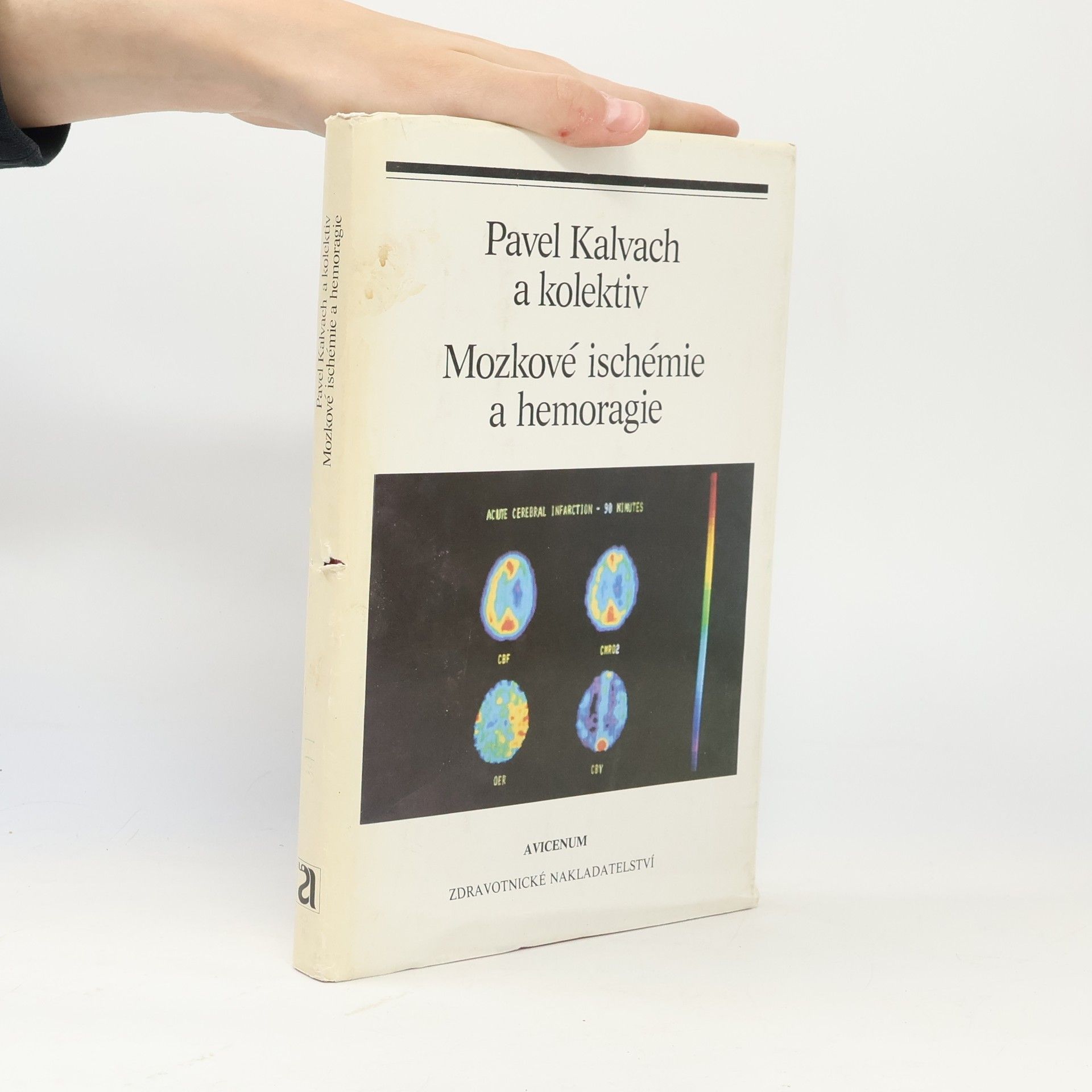 Pavel Kalvach Mozkové ischemie a hemoragie