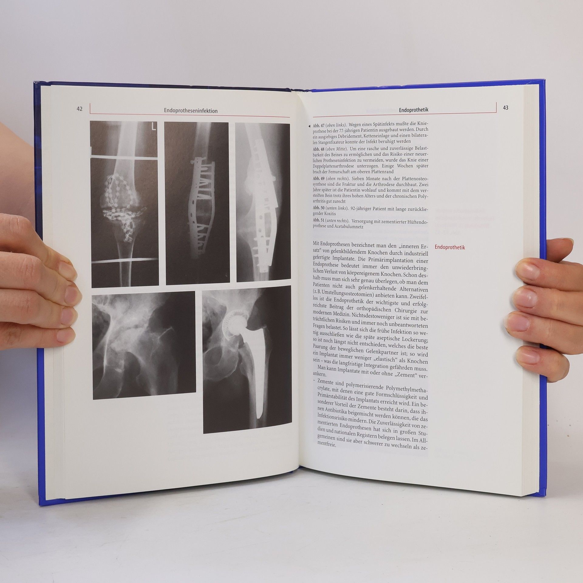 J. Rüdiger Döhler Lexikon Orthopädische Chirurgie
