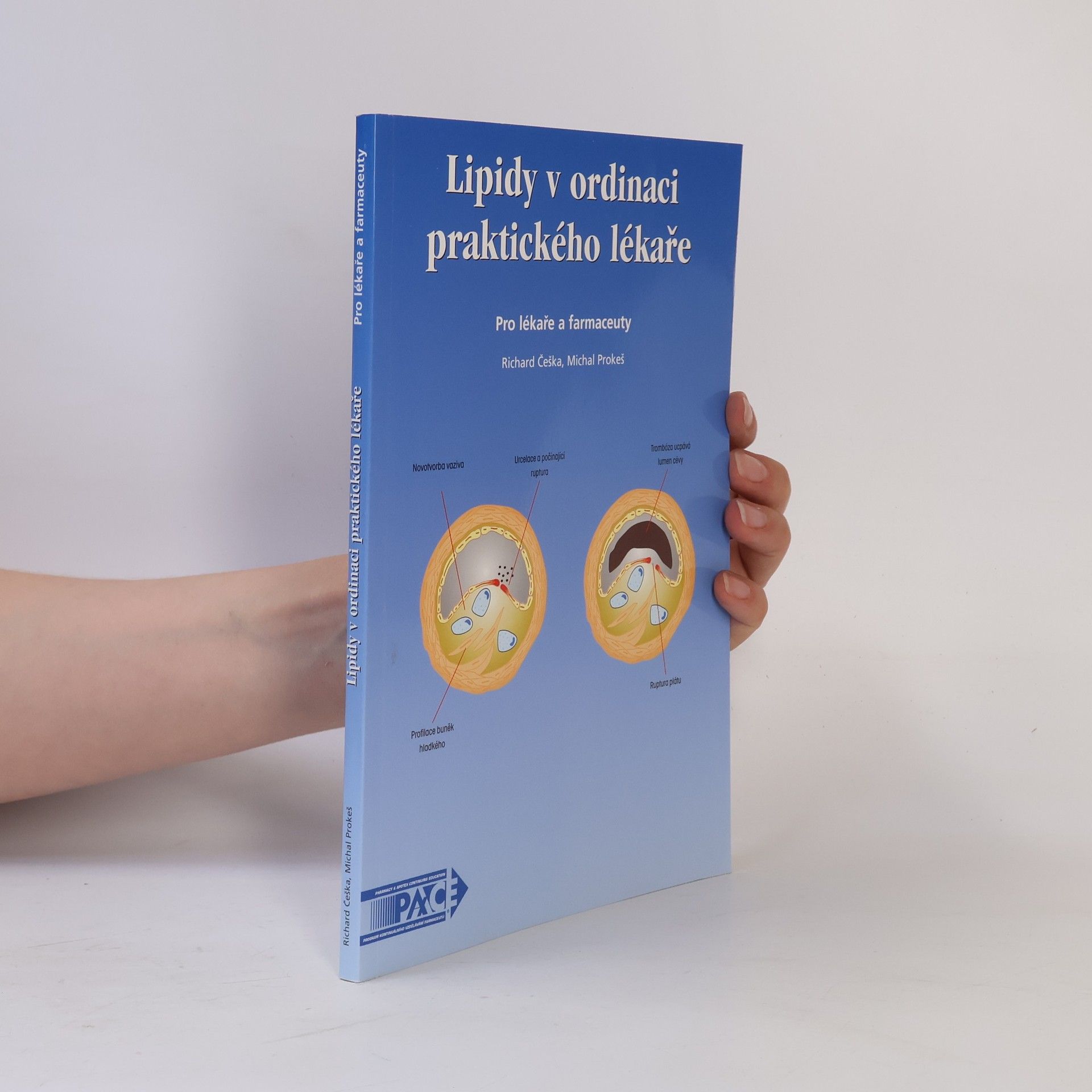 Michal Prokeš Lipidy v ordinaci praktického lékaře. Pro lékaře a farmaceuty