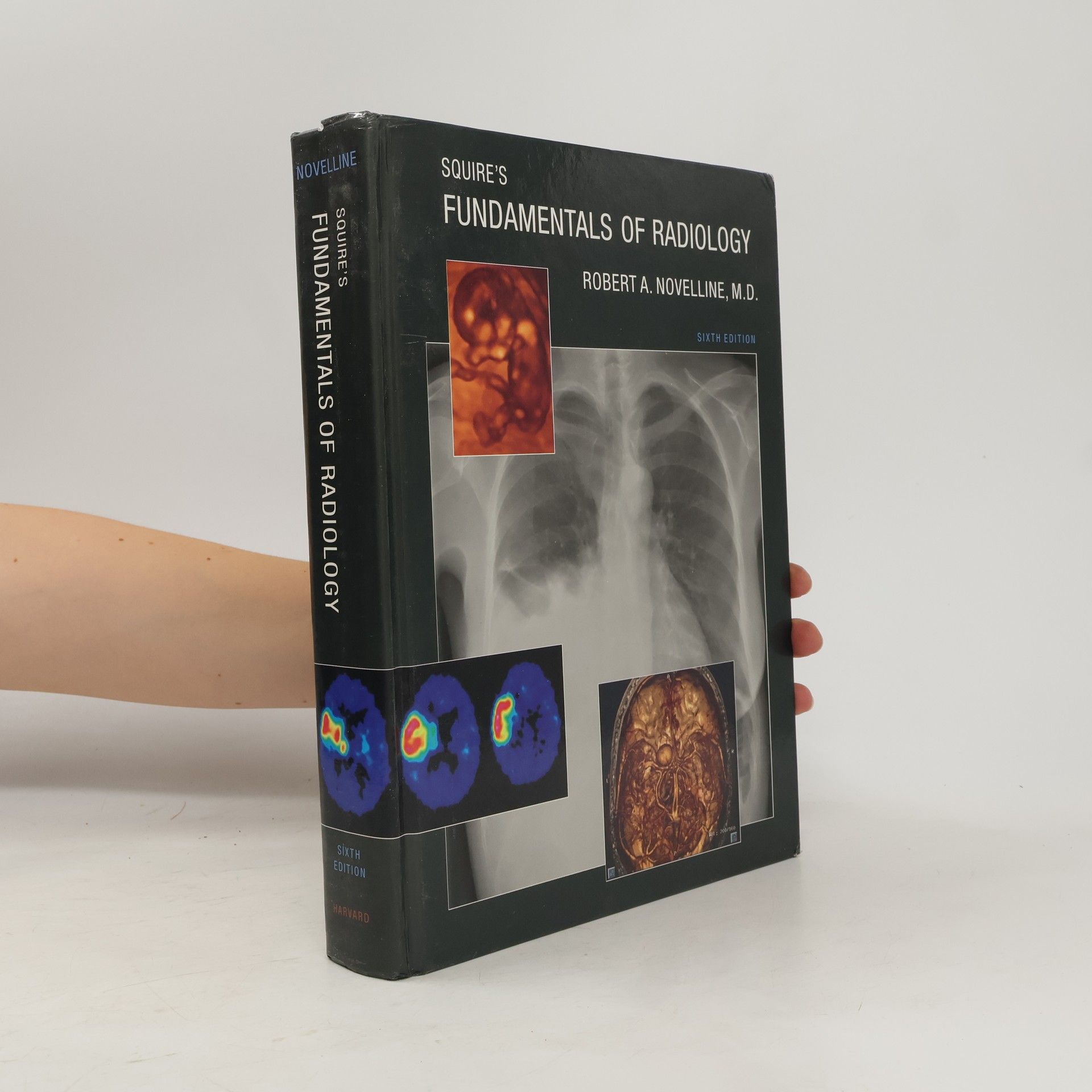 Lucy Frank Squire Squire’s Fundamentals of Radiology