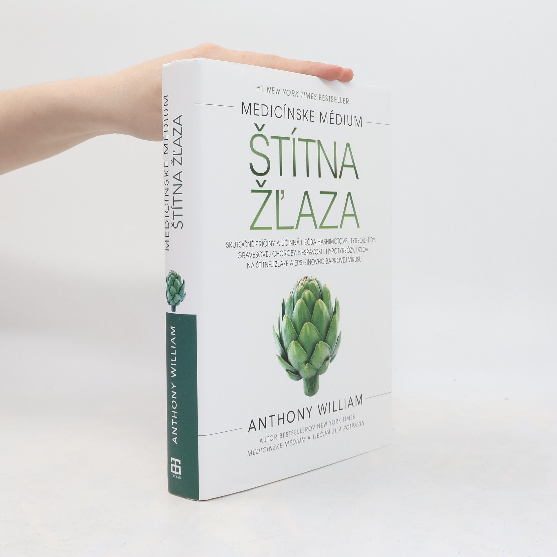 Anthony William Štítna žľaza