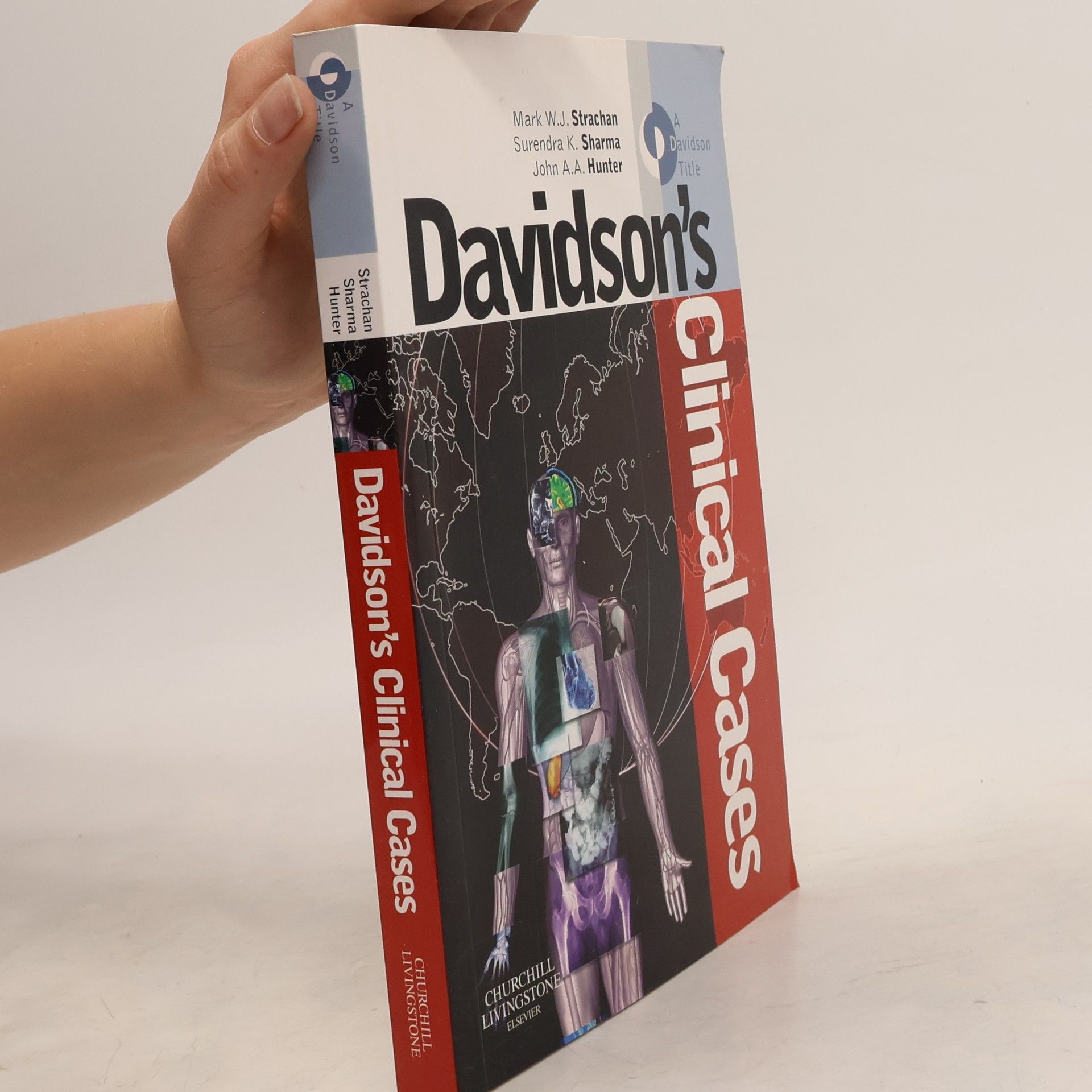 S. K. Surendra K. Sharma Davidson's Clinical Cases